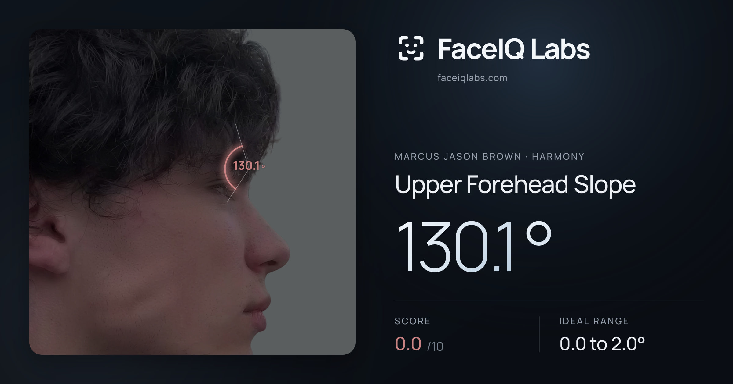 Marcus Jason Brown Upper Forehead Slope: 130.1°, drawn on the photo