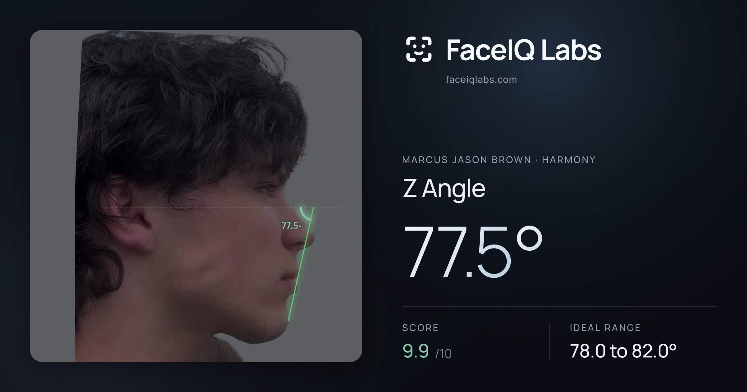 Marcus Jason Brown Z Angle: 77.5°, drawn on the photo