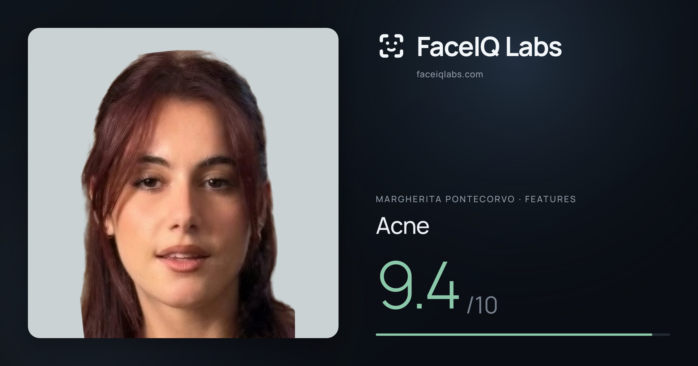 Margherita Pontecorvo Acne: 9.4/10, drawn on the photo