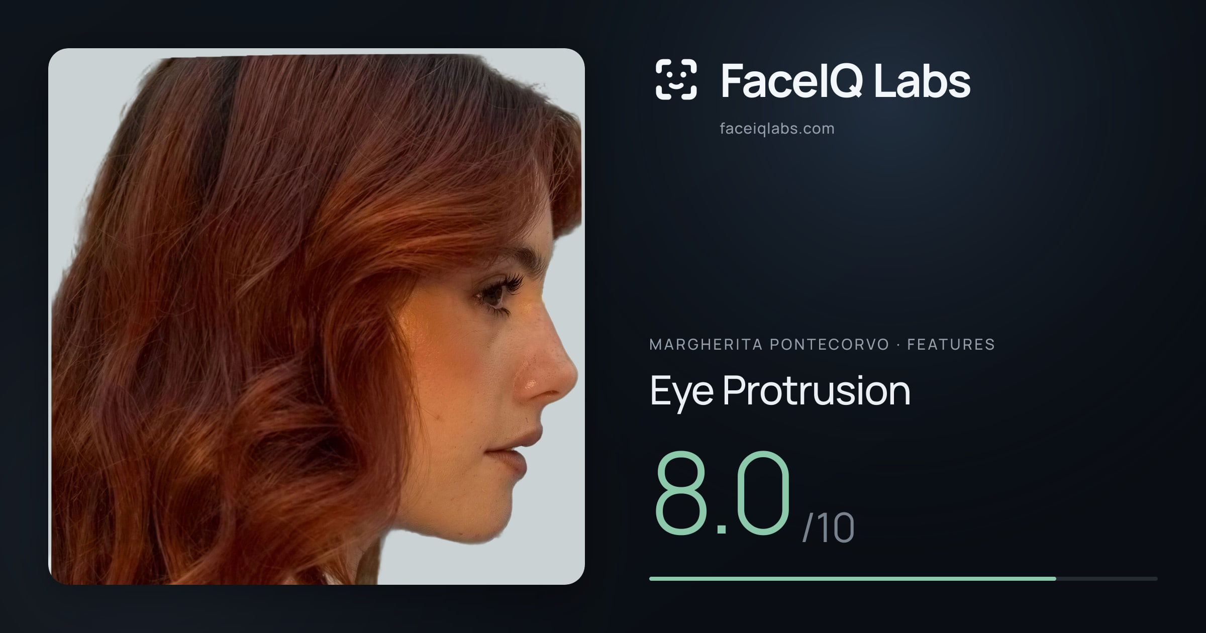 Margherita Pontecorvo Eye Protrusion: 8.0/10, drawn on the photo