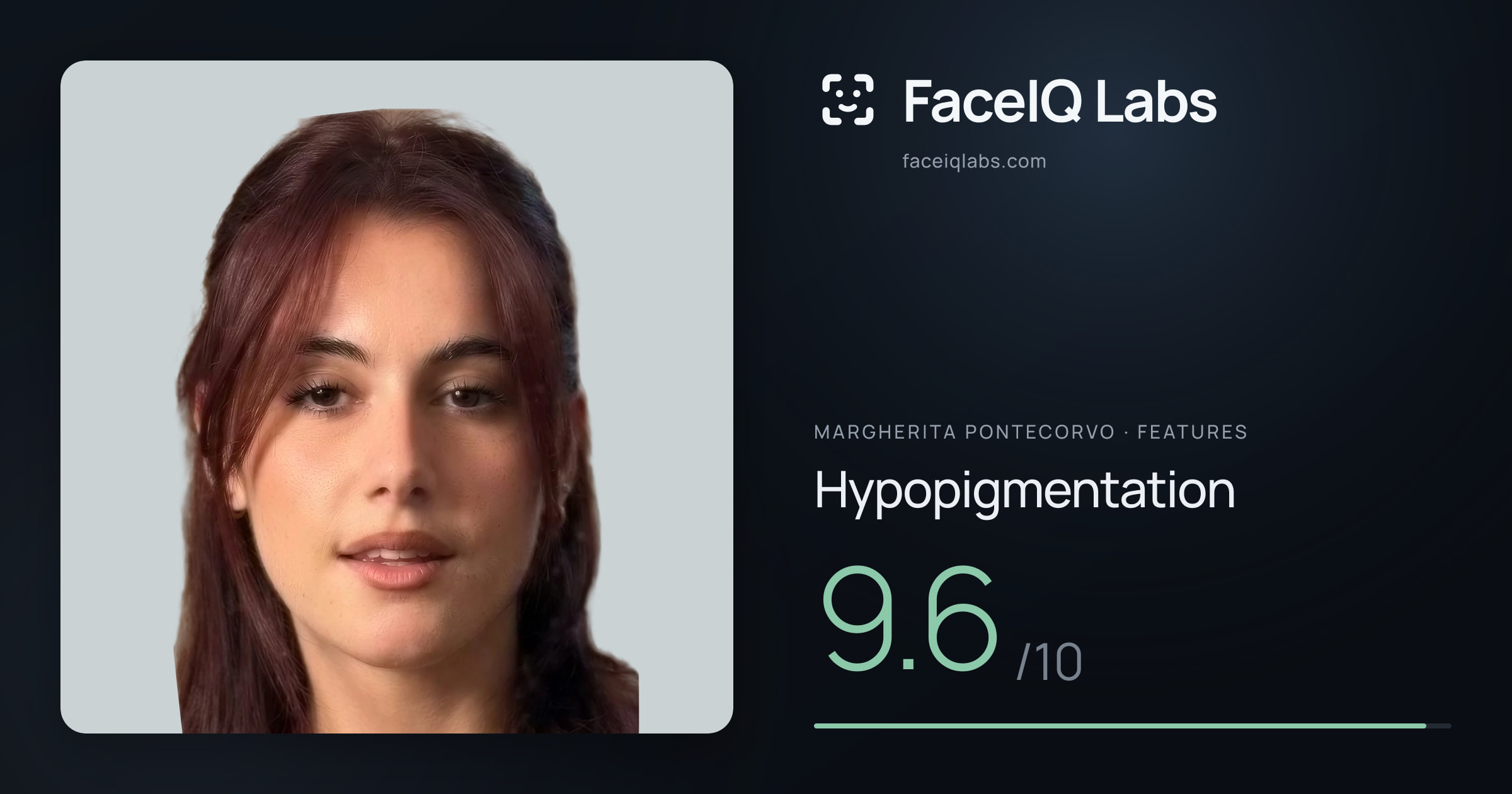 Margherita Pontecorvo Hypopigmentation: 9.6/10, drawn on the photo