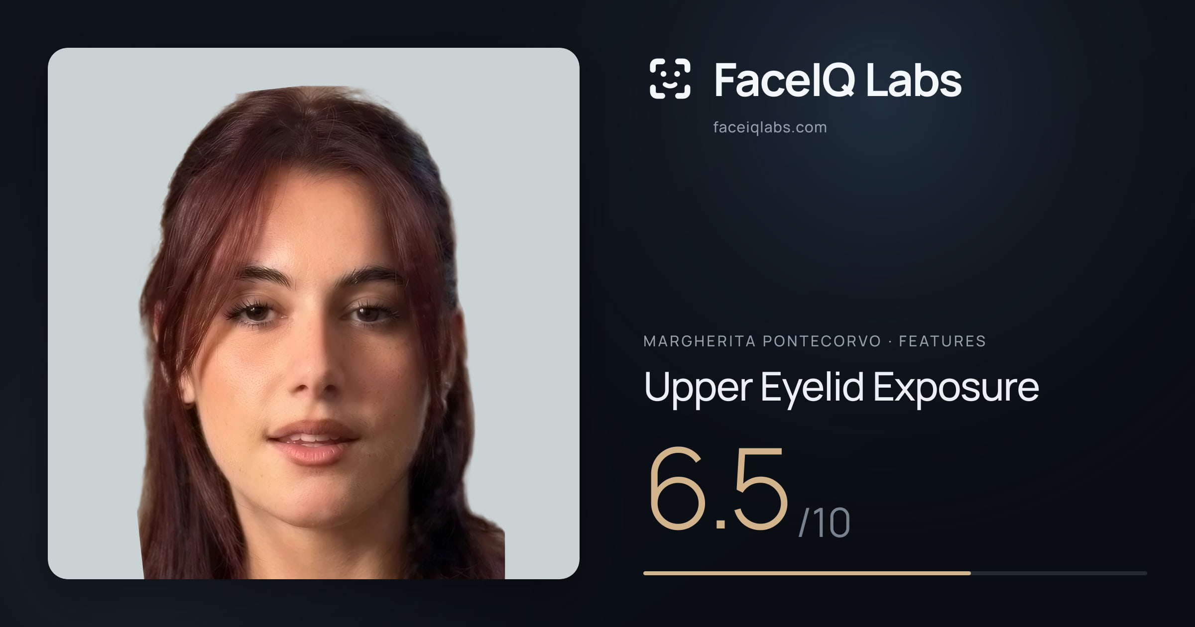 Margherita Pontecorvo Upper Eyelid Exposure: 6.5/10, drawn on the photo