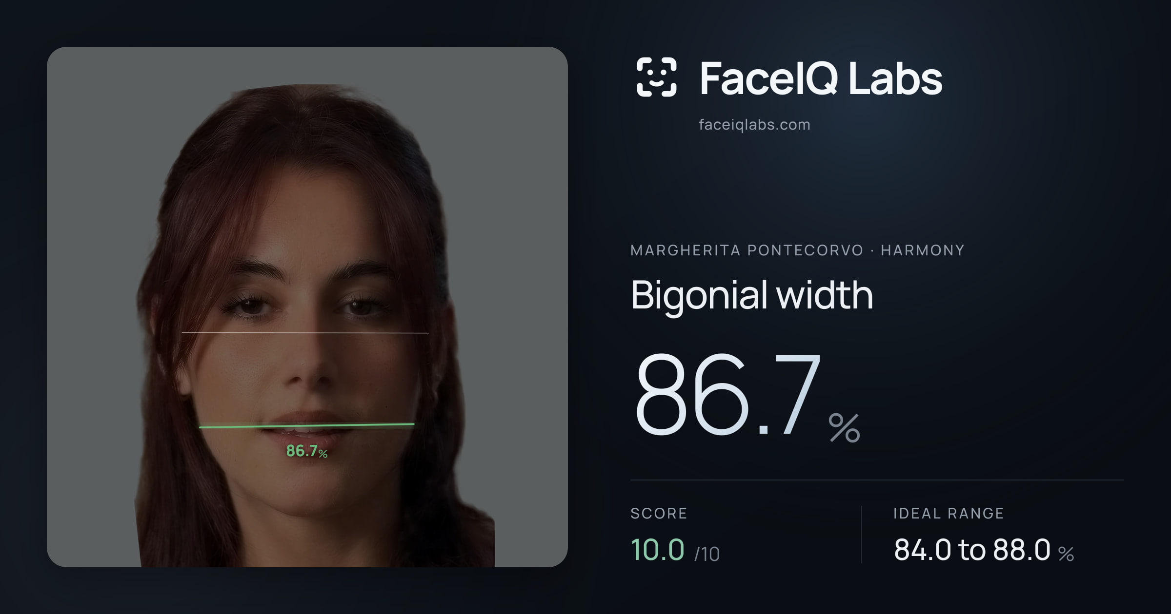 Margherita Pontecorvo Bigonial width: 86.7%, drawn on the photo