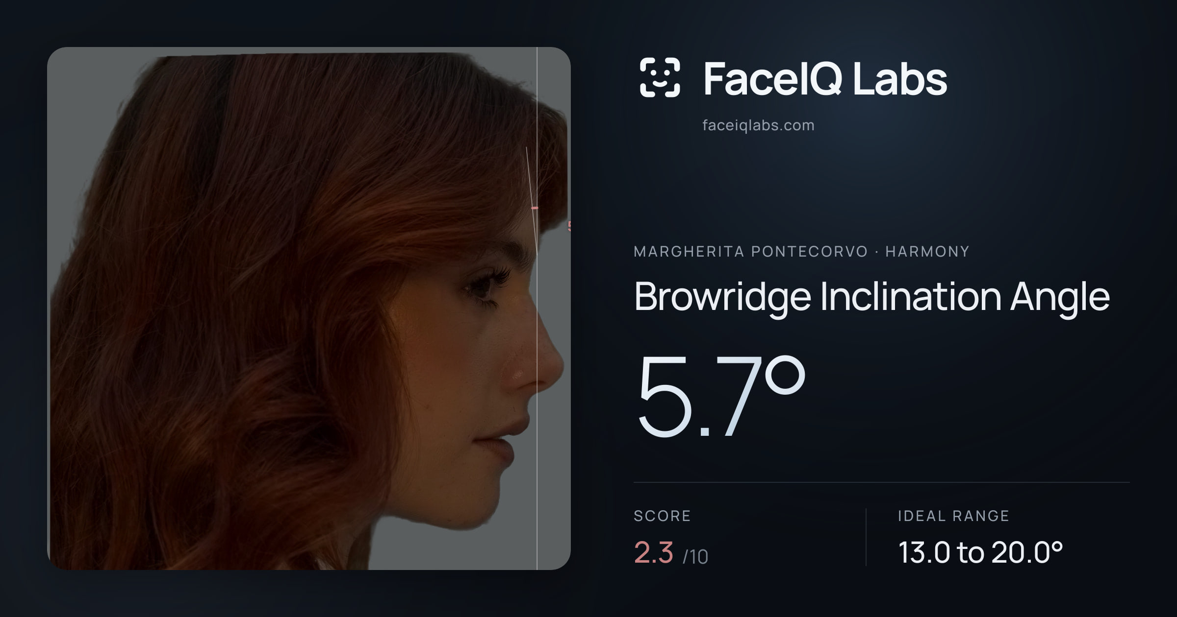 Margherita Pontecorvo Browridge Inclination Angle: 5.7°, drawn on the photo