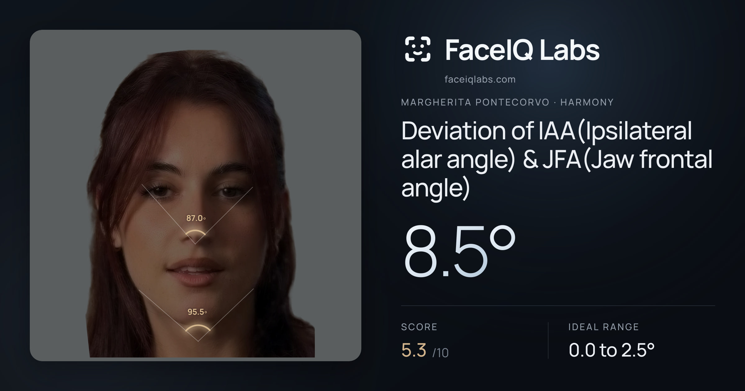 Margherita Pontecorvo Deviation of IAA(Ipsilateral alar angle) & JFA(Jaw frontal angle): 8.5°, drawn on the photo