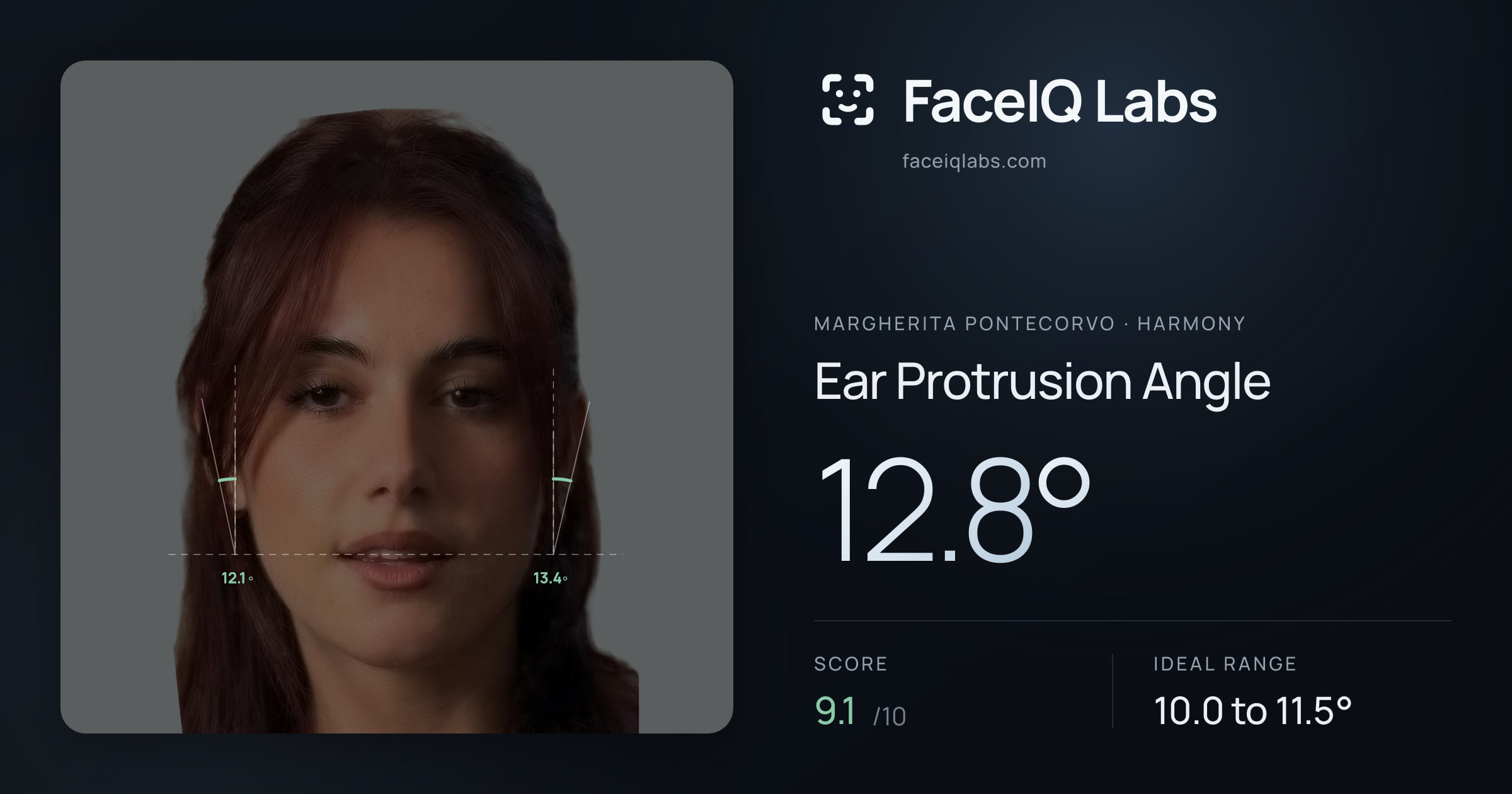 Margherita Pontecorvo Ear Protrusion Angle: 12.8°, drawn on the photo