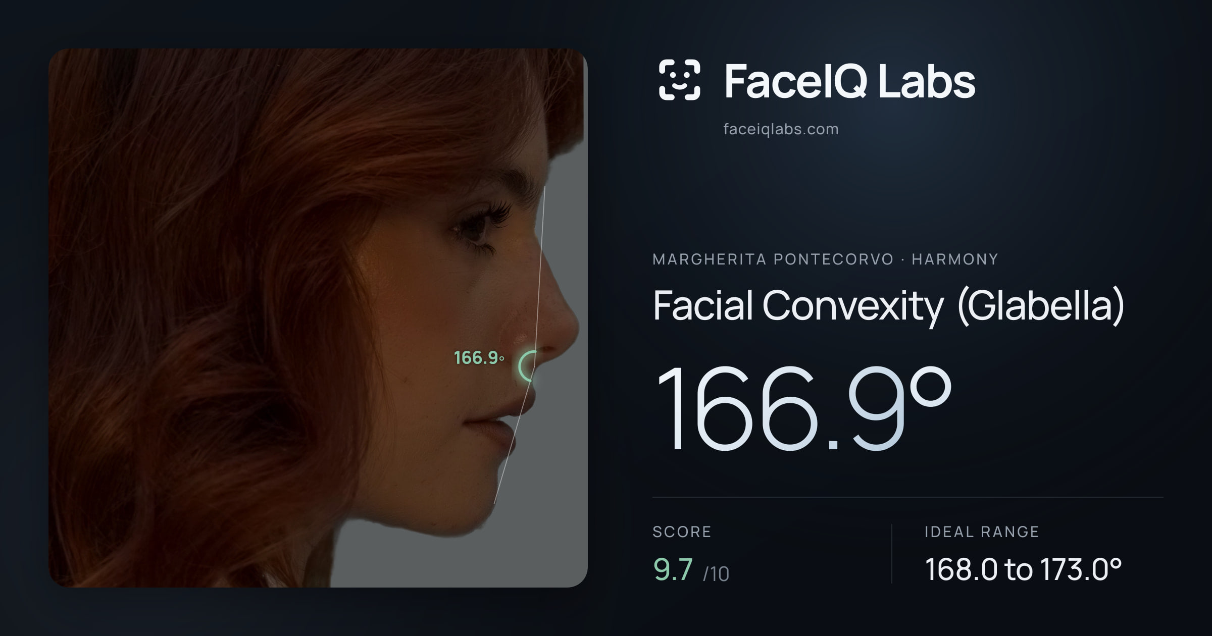 Margherita Pontecorvo Facial Convexity (Glabella): 166.9°, drawn on the photo