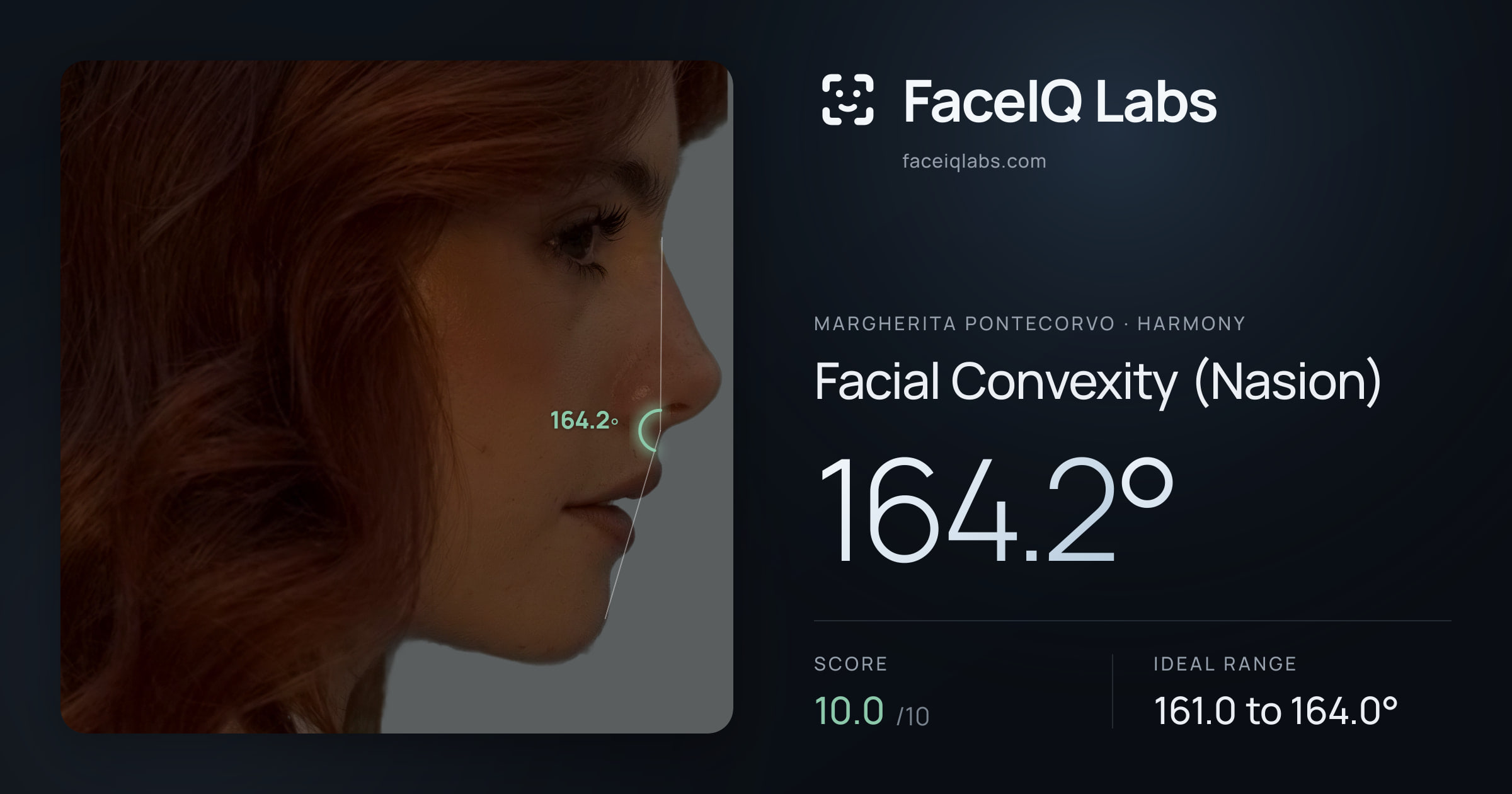 Margherita Pontecorvo Facial Convexity (Nasion): 164.2°, drawn on the photo