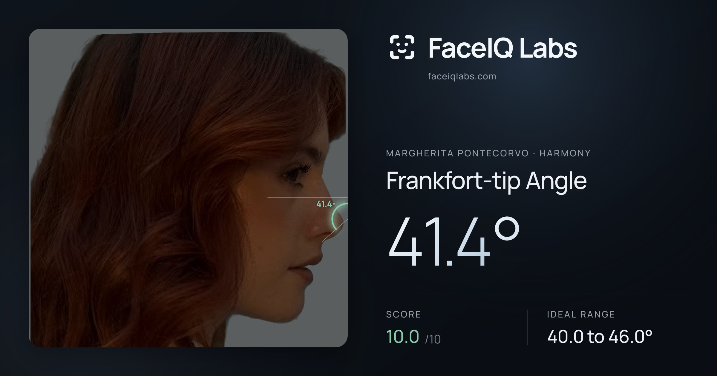 Margherita Pontecorvo Frankfort-tip Angle: 41.4°, drawn on the photo