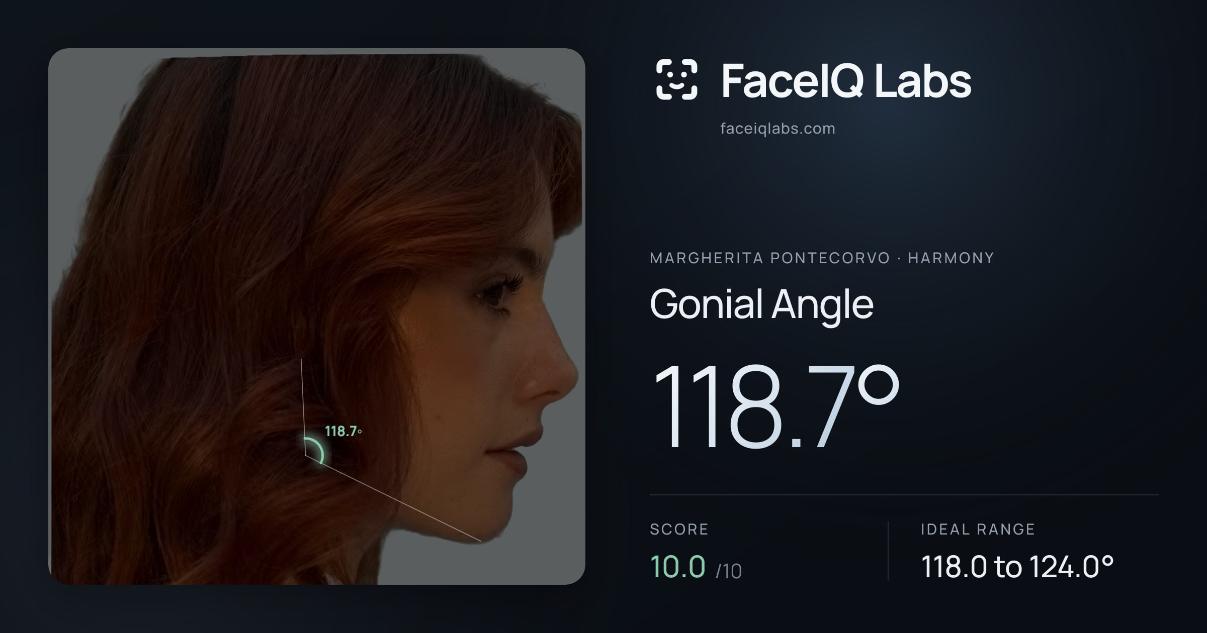 Margherita Pontecorvo Gonial Angle: 118.7°, drawn on the photo