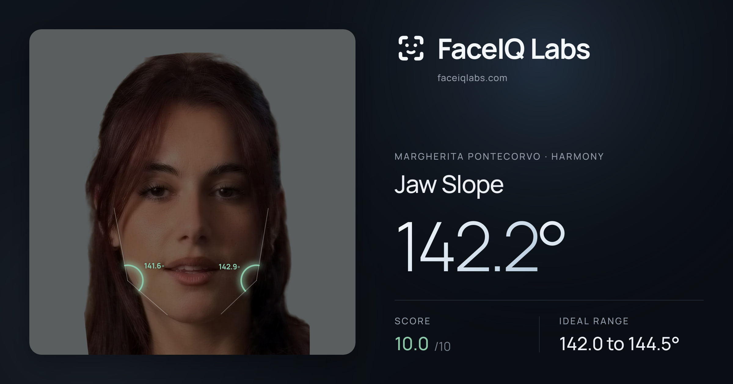 Margherita Pontecorvo Jaw Slope: 142.2°, drawn on the photo