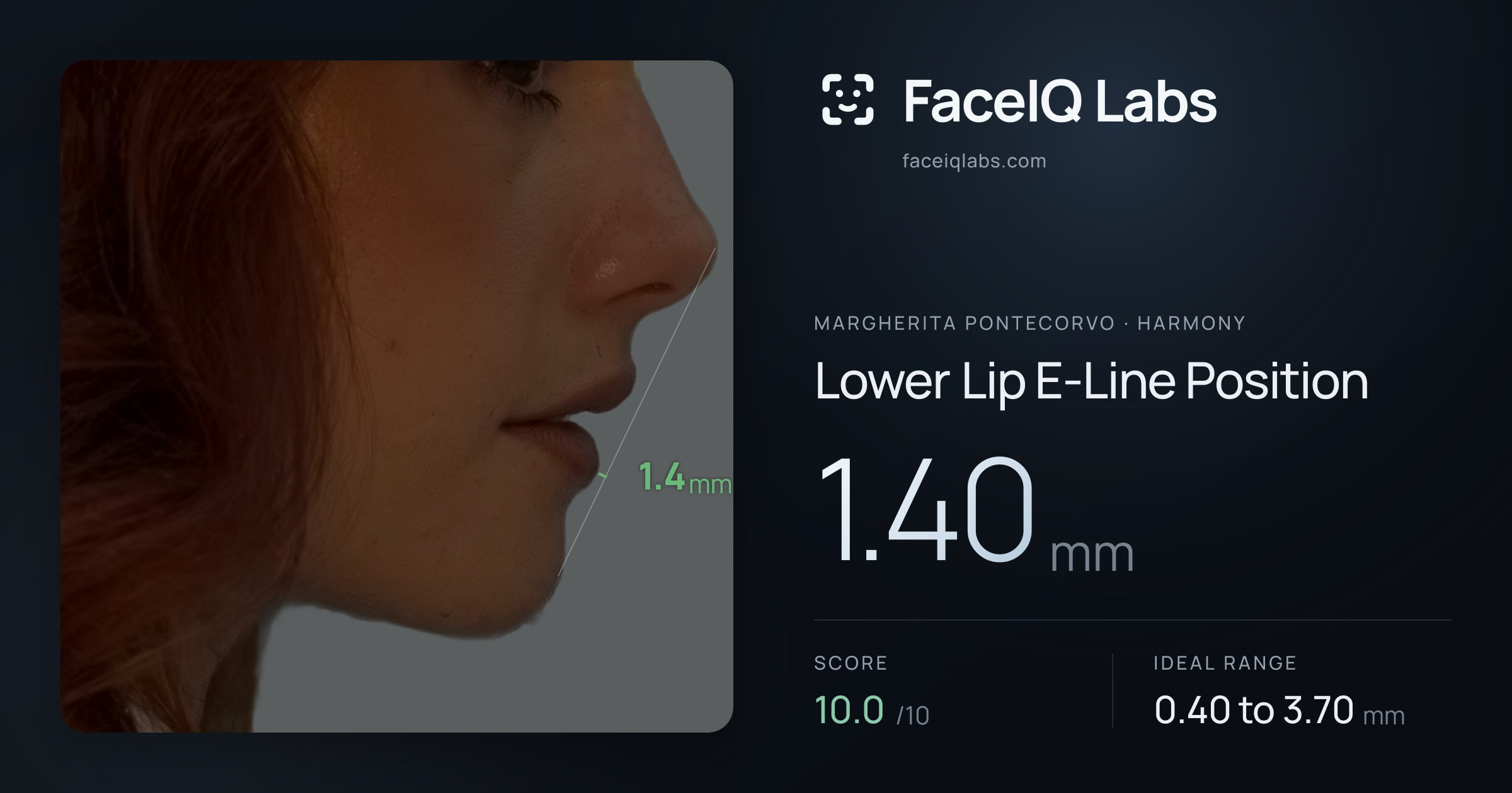 Margherita Pontecorvo Lower Lip E-Line Position: 1.40mm, drawn on the photo