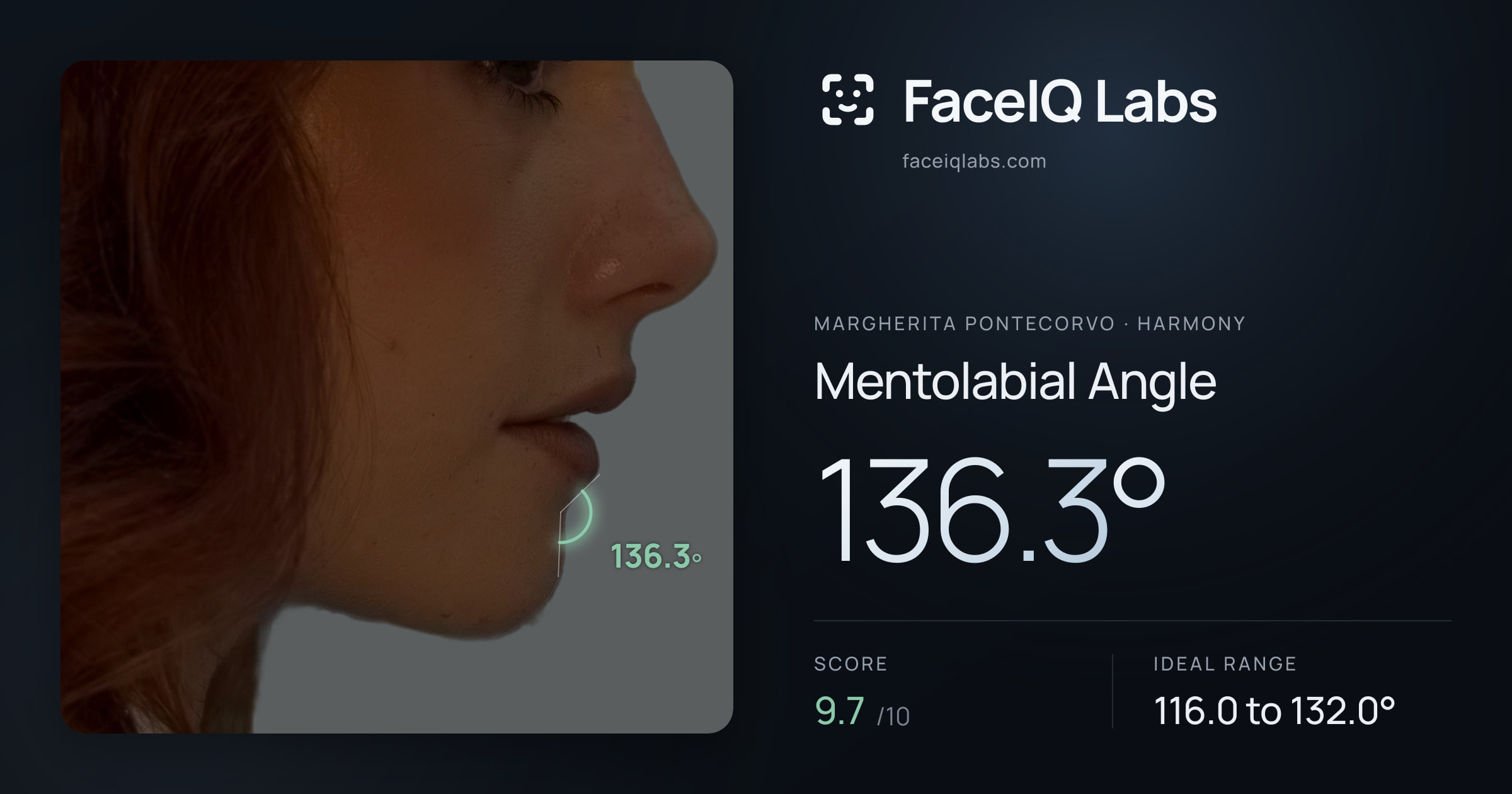 Margherita Pontecorvo Mentolabial Angle: 136.3°, drawn on the photo