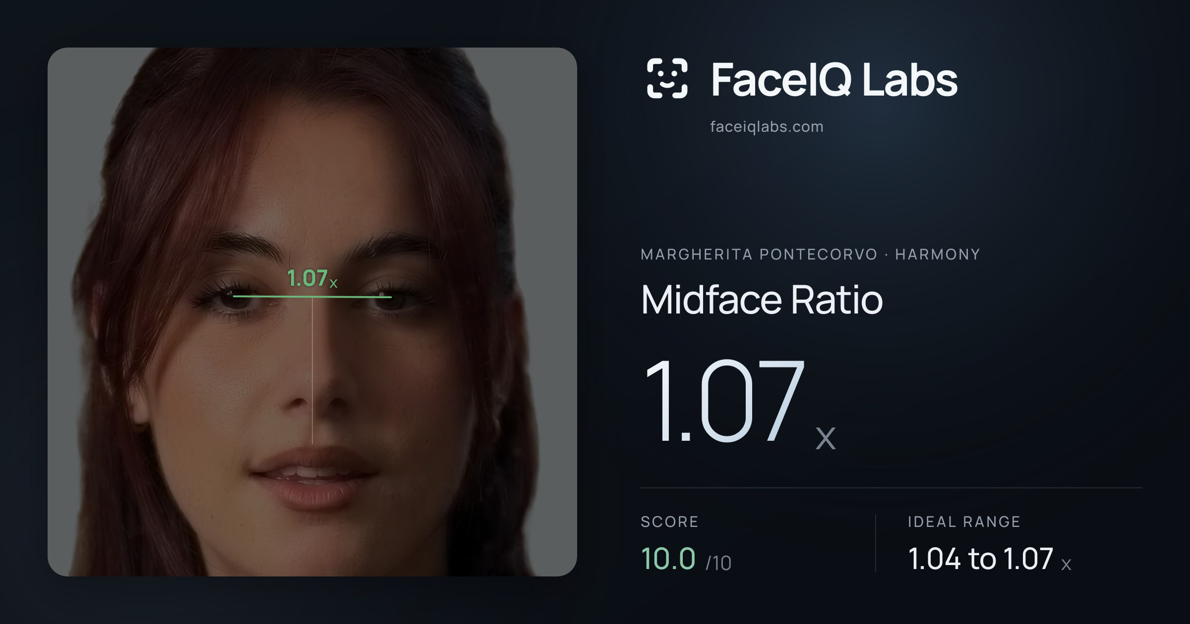 Margherita Pontecorvo Midface Ratio: 1.07x, drawn on the photo
