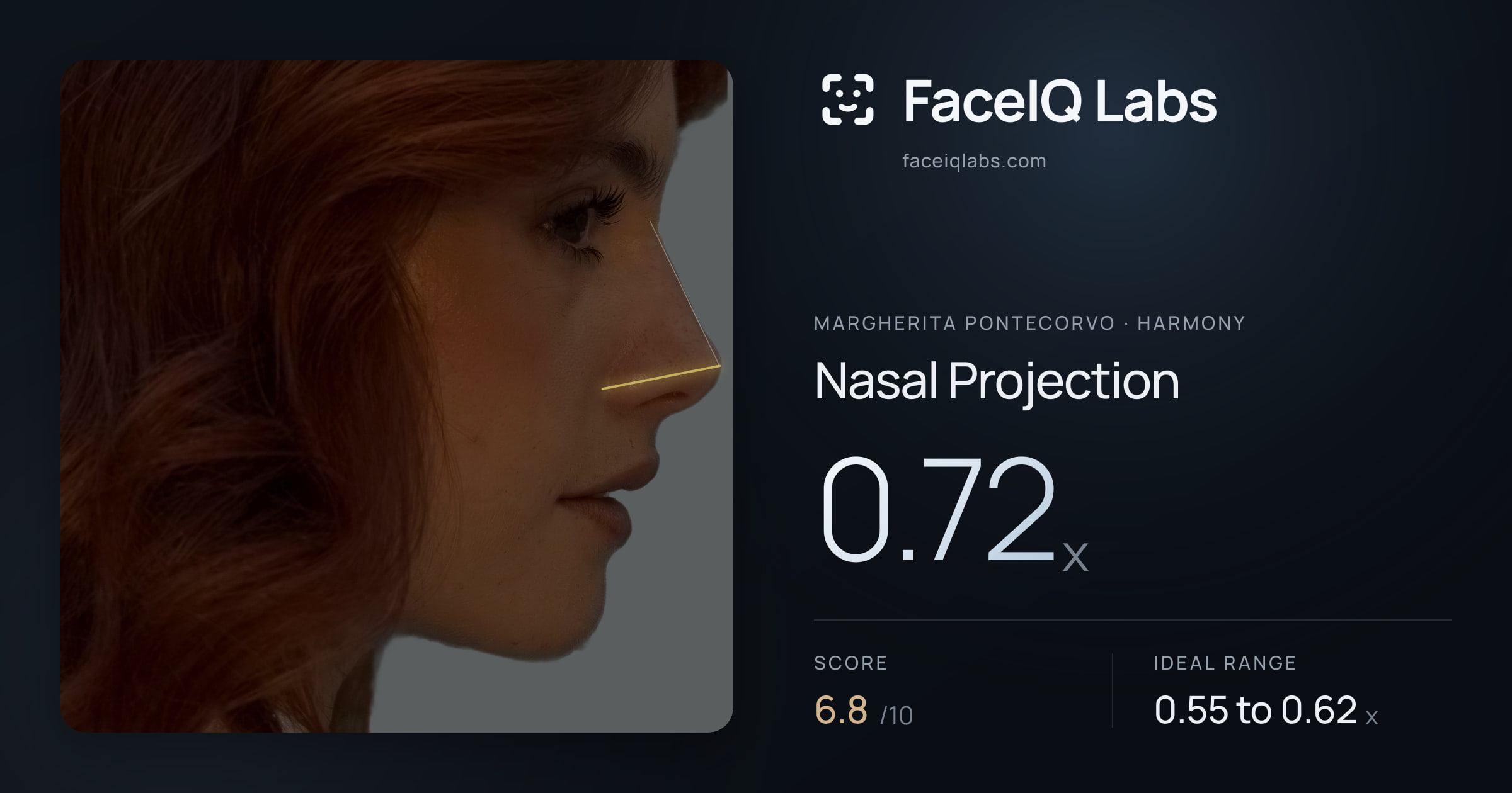 Margherita Pontecorvo Nasal Projection: 0.72x, drawn on the photo
