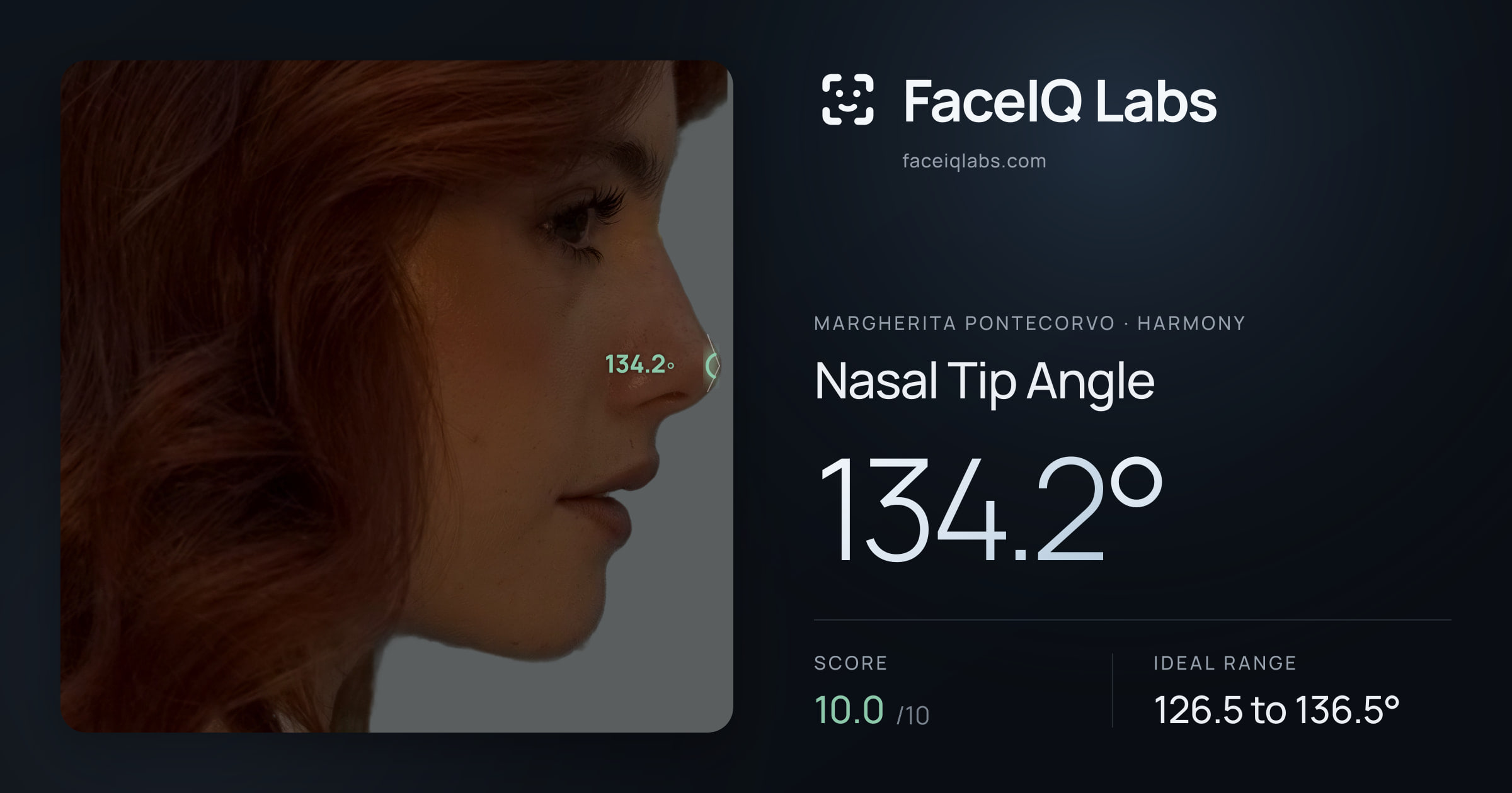 Margherita Pontecorvo Nasal Tip Angle: 134.2°, drawn on the photo