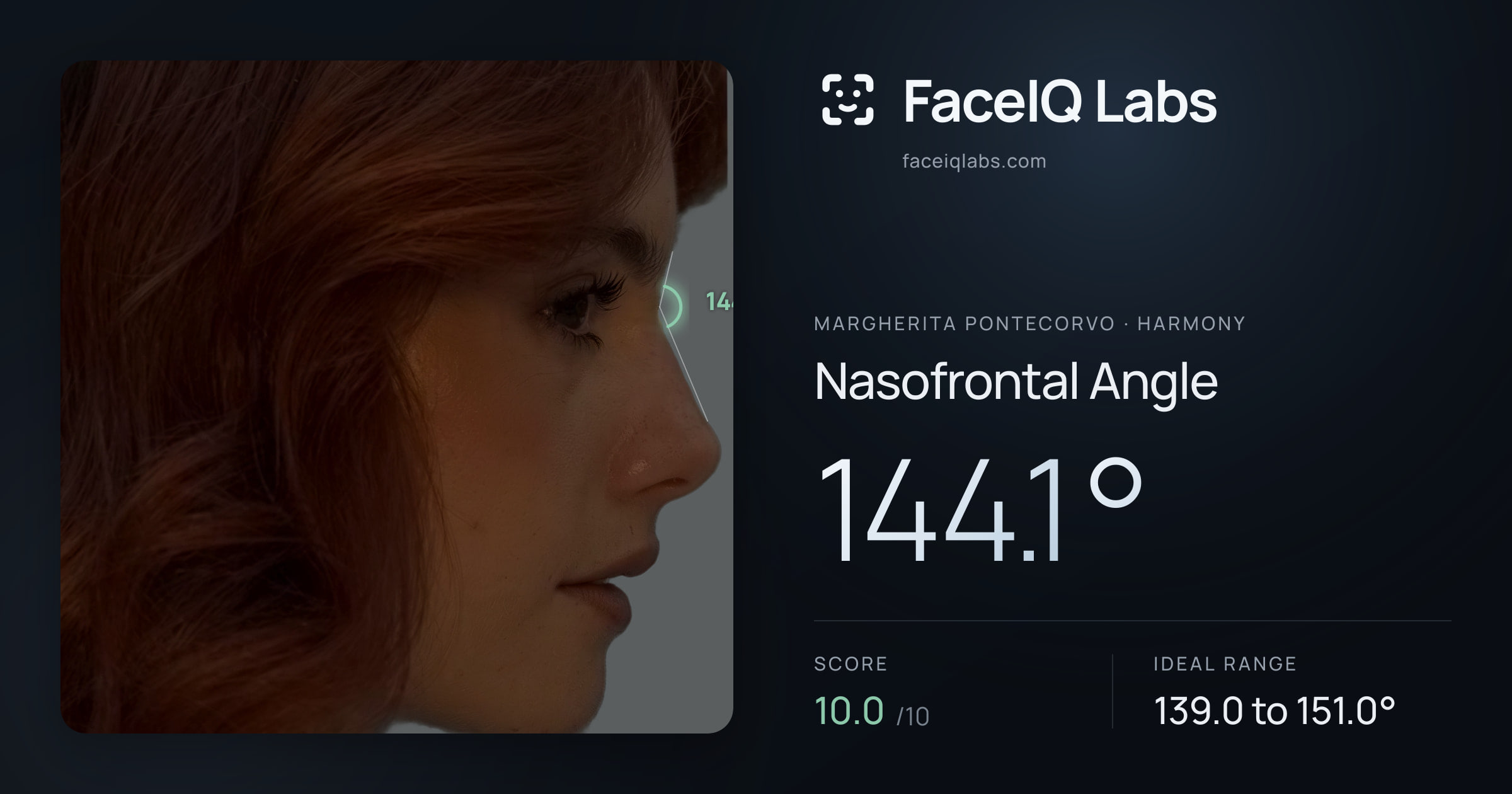 Margherita Pontecorvo Nasofrontal Angle: 144.1°, drawn on the photo