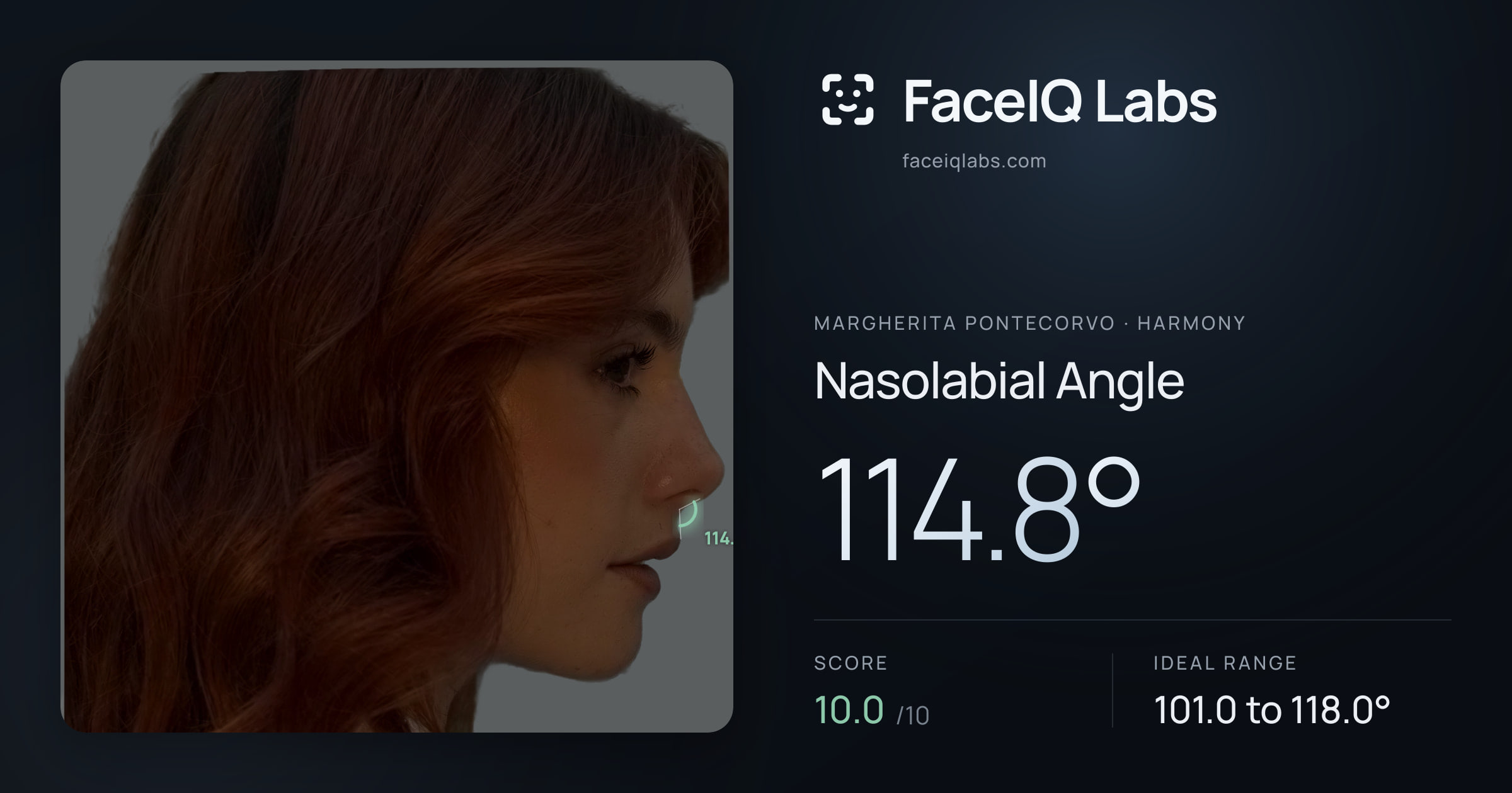 Margherita Pontecorvo Nasolabial Angle: 114.8°, drawn on the photo
