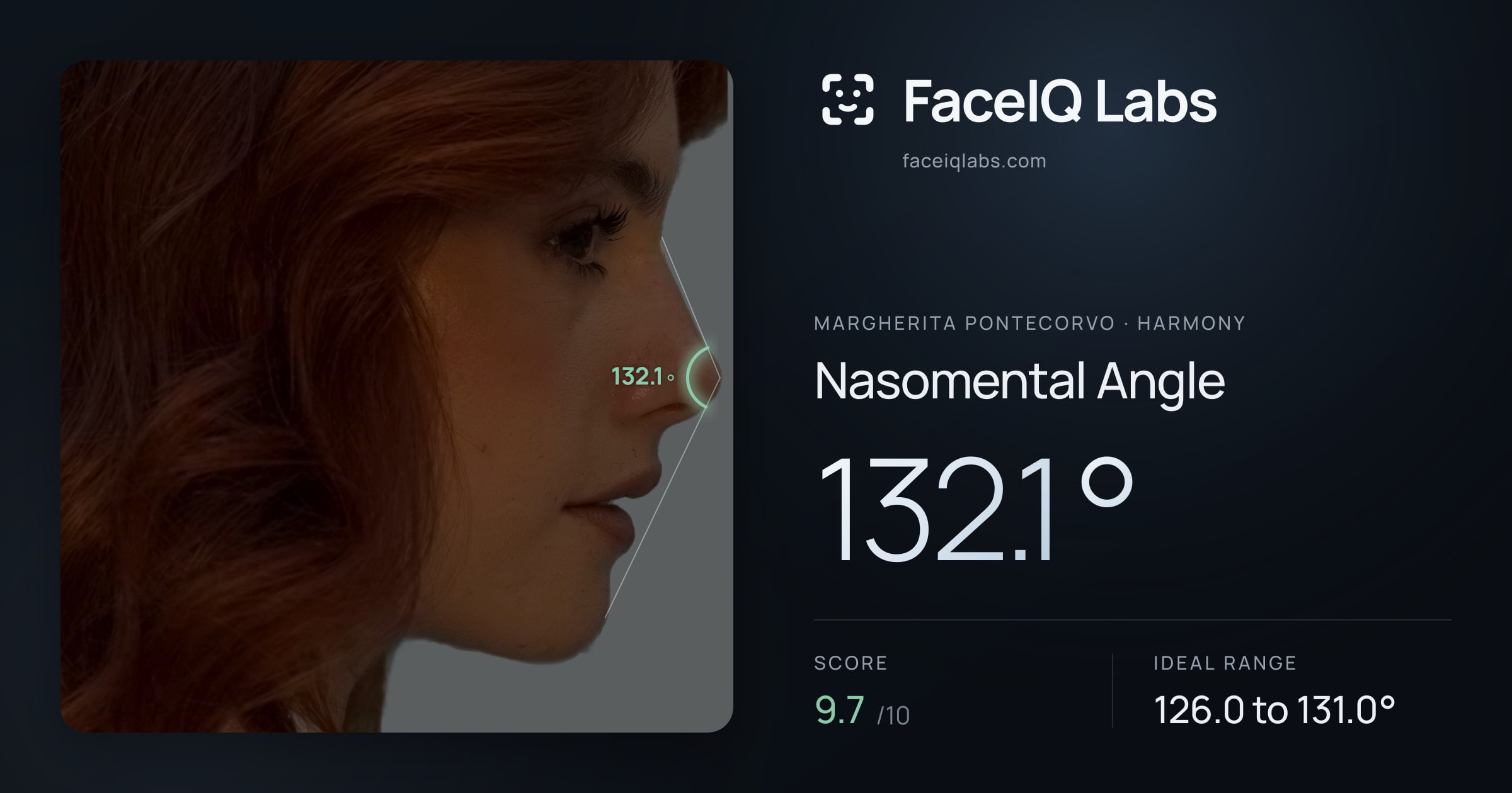 Margherita Pontecorvo Nasomental Angle: 132.1°, drawn on the photo