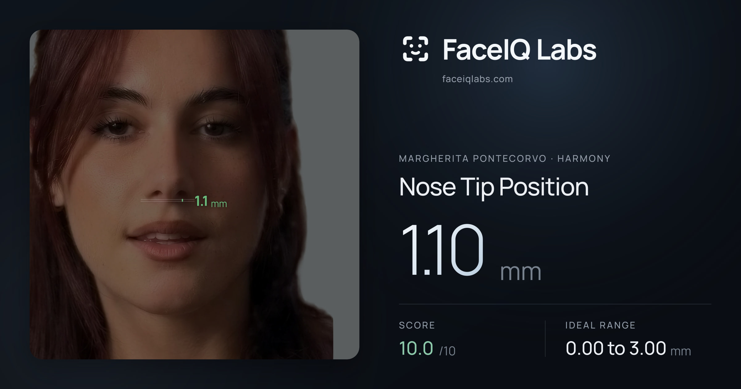 Margherita Pontecorvo Nose Tip Position: 1.10mm, drawn on the photo