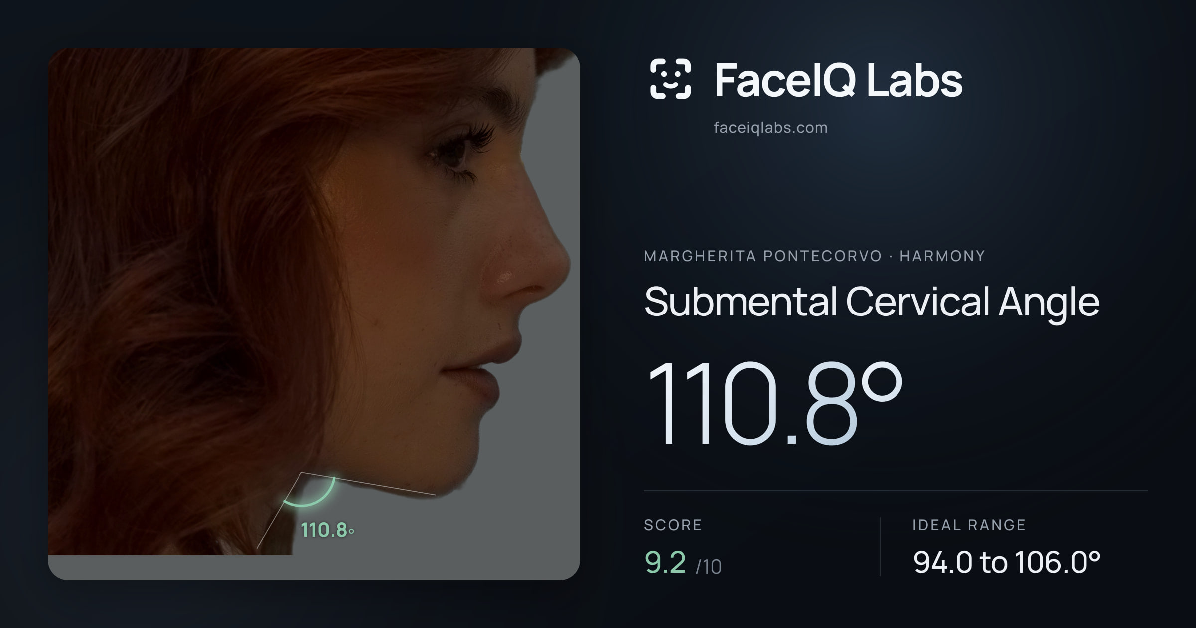 Margherita Pontecorvo Submental Cervical Angle: 110.8°, drawn on the photo