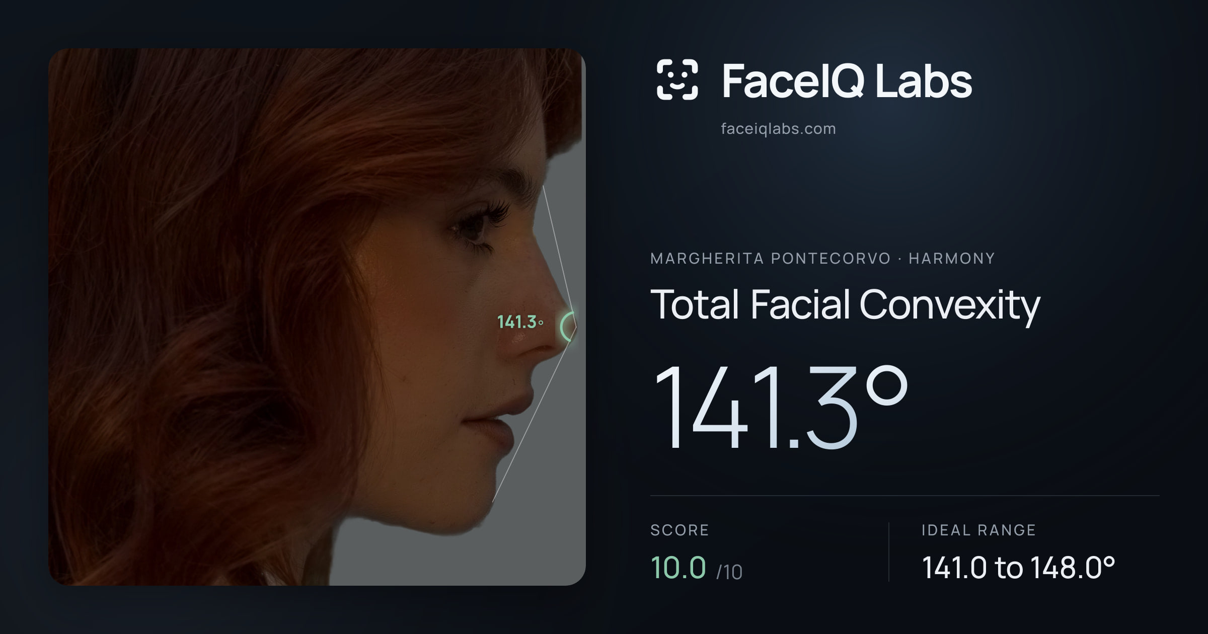 Margherita Pontecorvo Total Facial Convexity: 141.3°, drawn on the photo