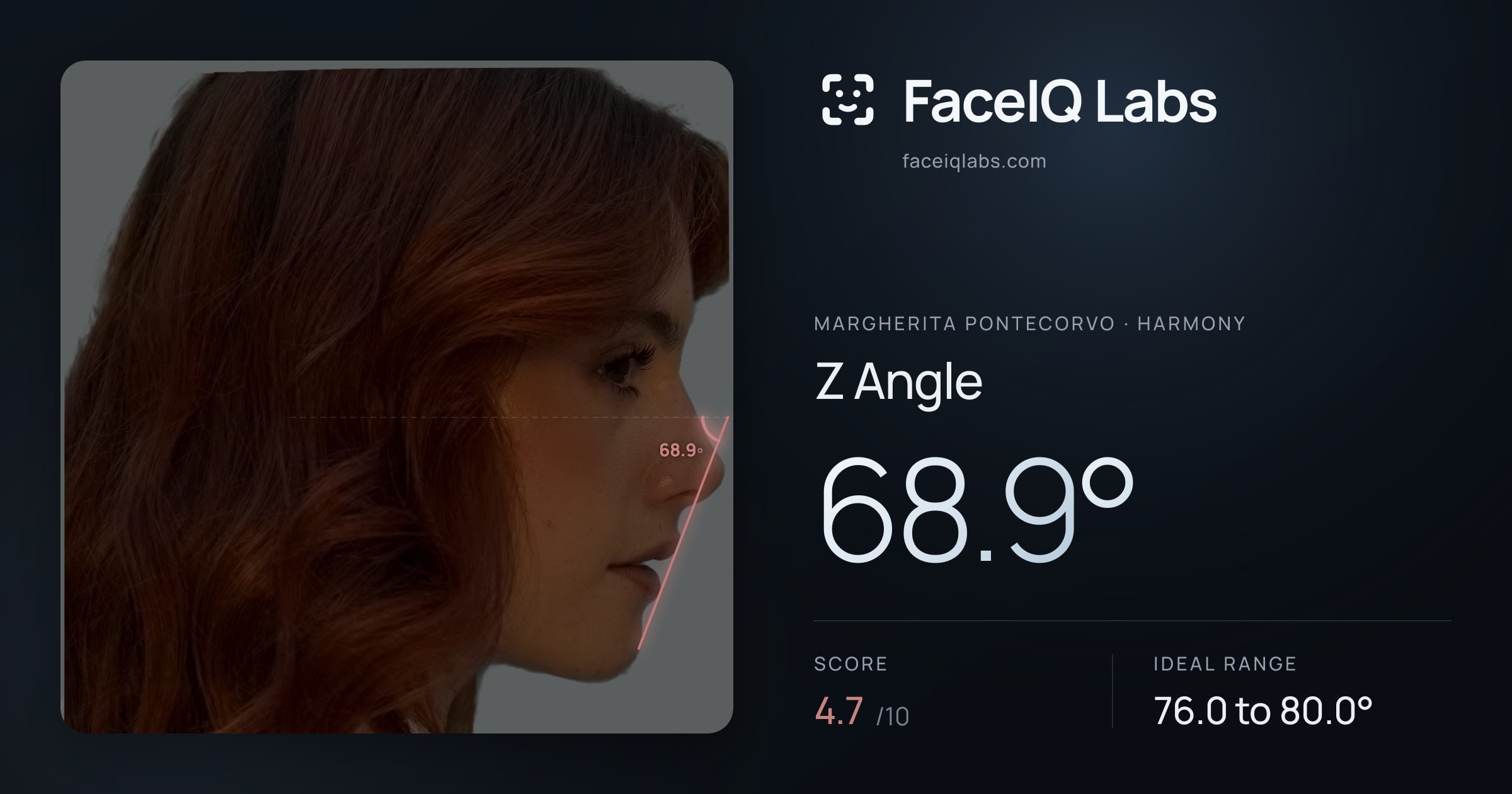 Margherita Pontecorvo Z Angle: 68.9°, drawn on the photo