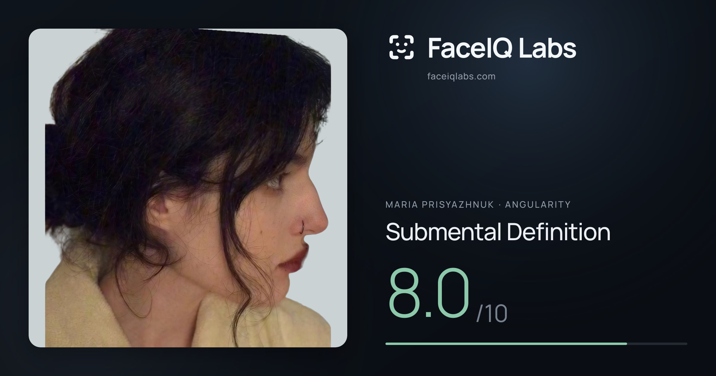 Maria Prisyazhnuk Submental Definition: 8.0/10, drawn on the photo