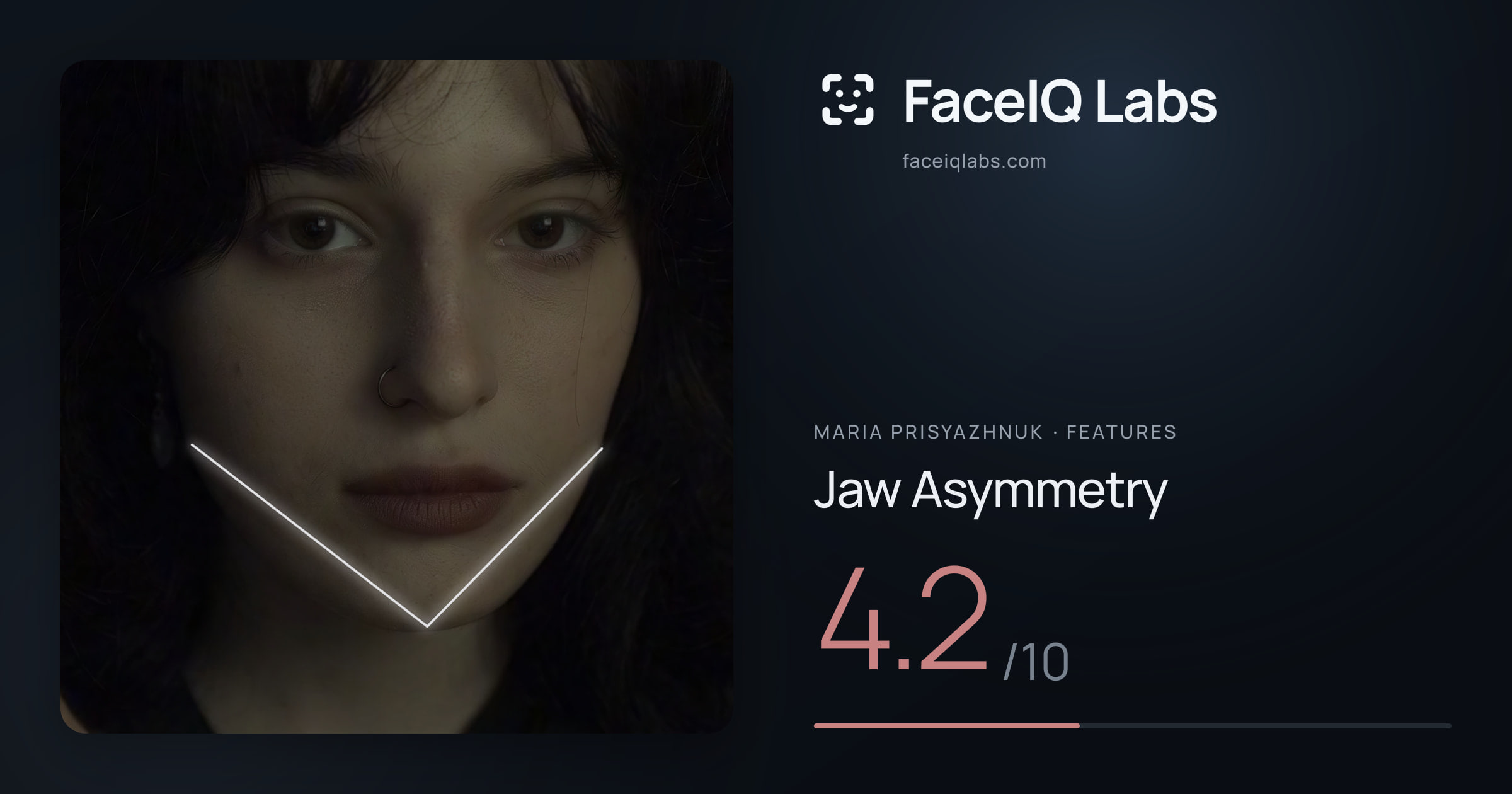 Maria Prisyazhnuk Jaw Asymmetry: 4.2/10, drawn on the photo