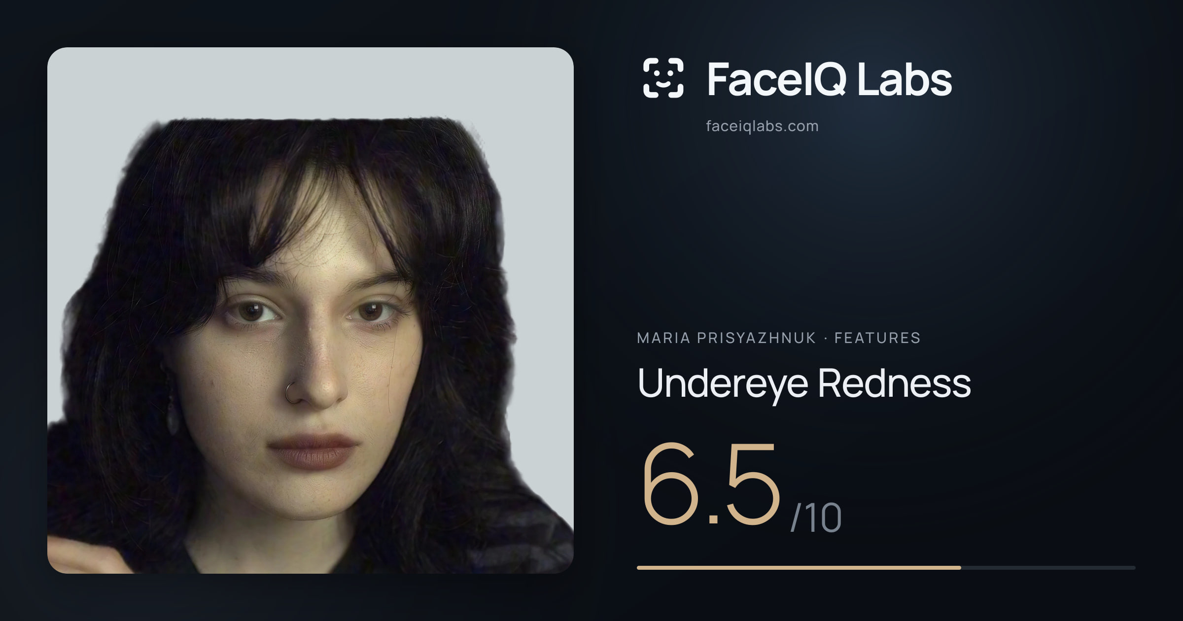 Maria Prisyazhnuk Undereye Redness: 6.5/10, drawn on the photo