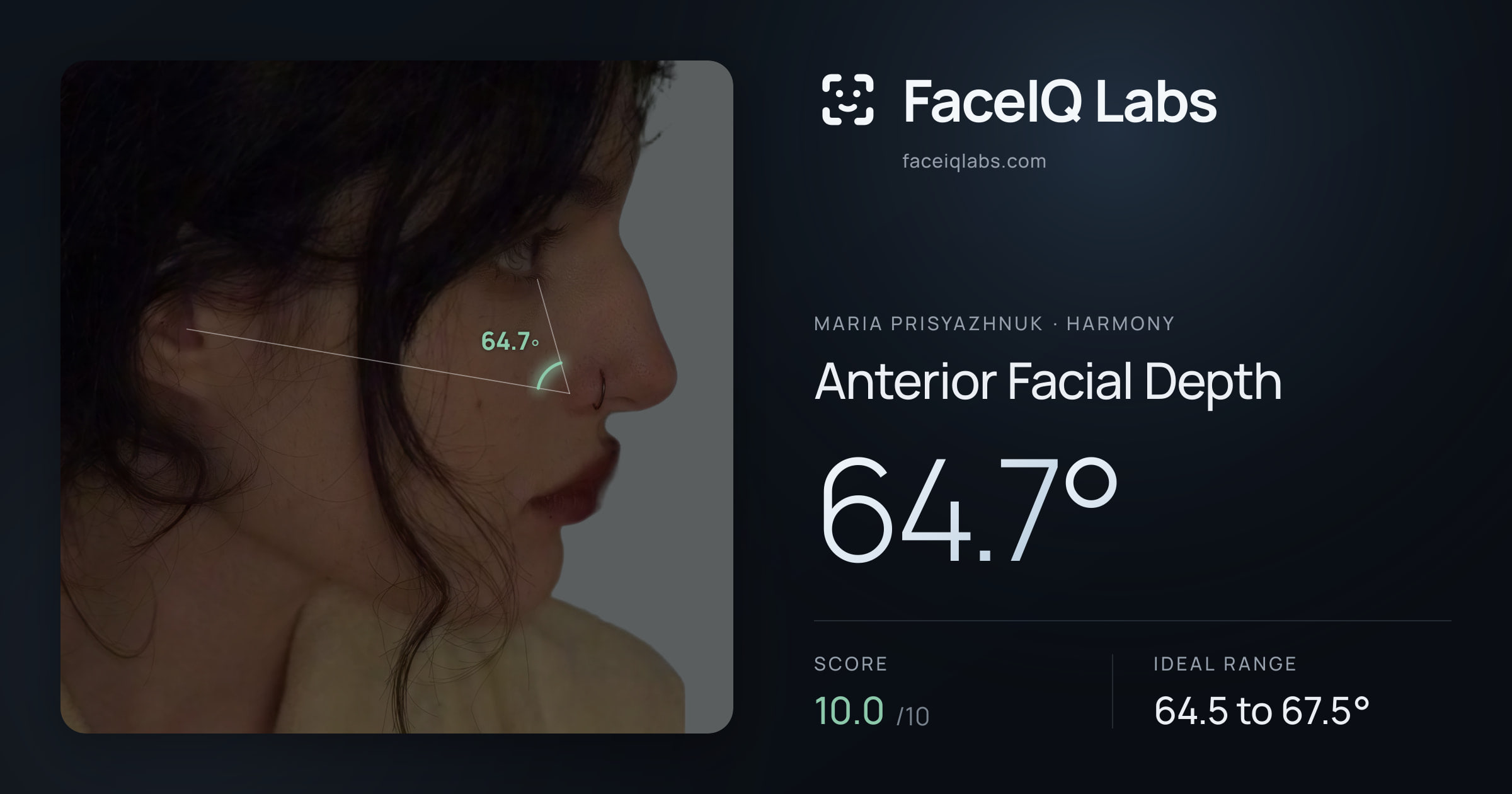 Maria Prisyazhnuk Anterior Facial Depth: 64.7°, drawn on the photo