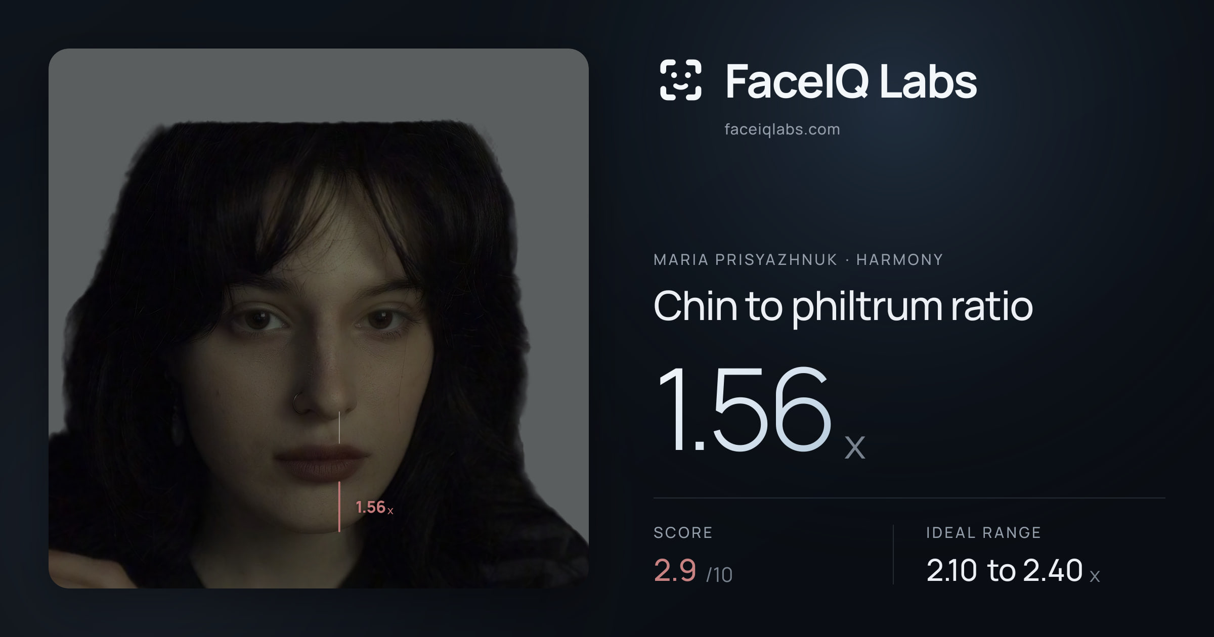 Maria Prisyazhnuk Chin to philtrum ratio: 1.56x, drawn on the photo