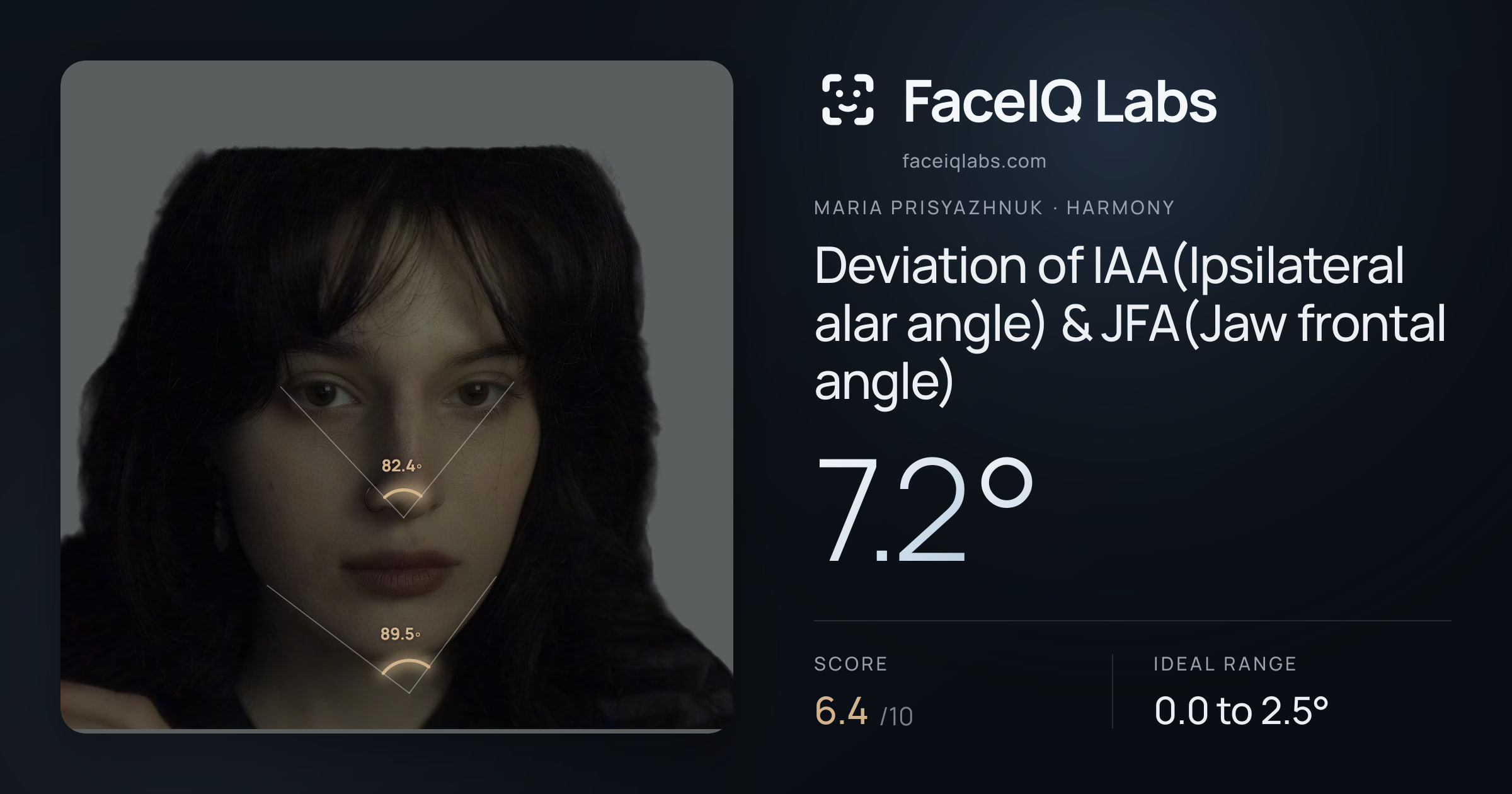 Maria Prisyazhnuk Deviation of IAA(Ipsilateral alar angle) & JFA(Jaw frontal angle): 7.2°, drawn on the photo