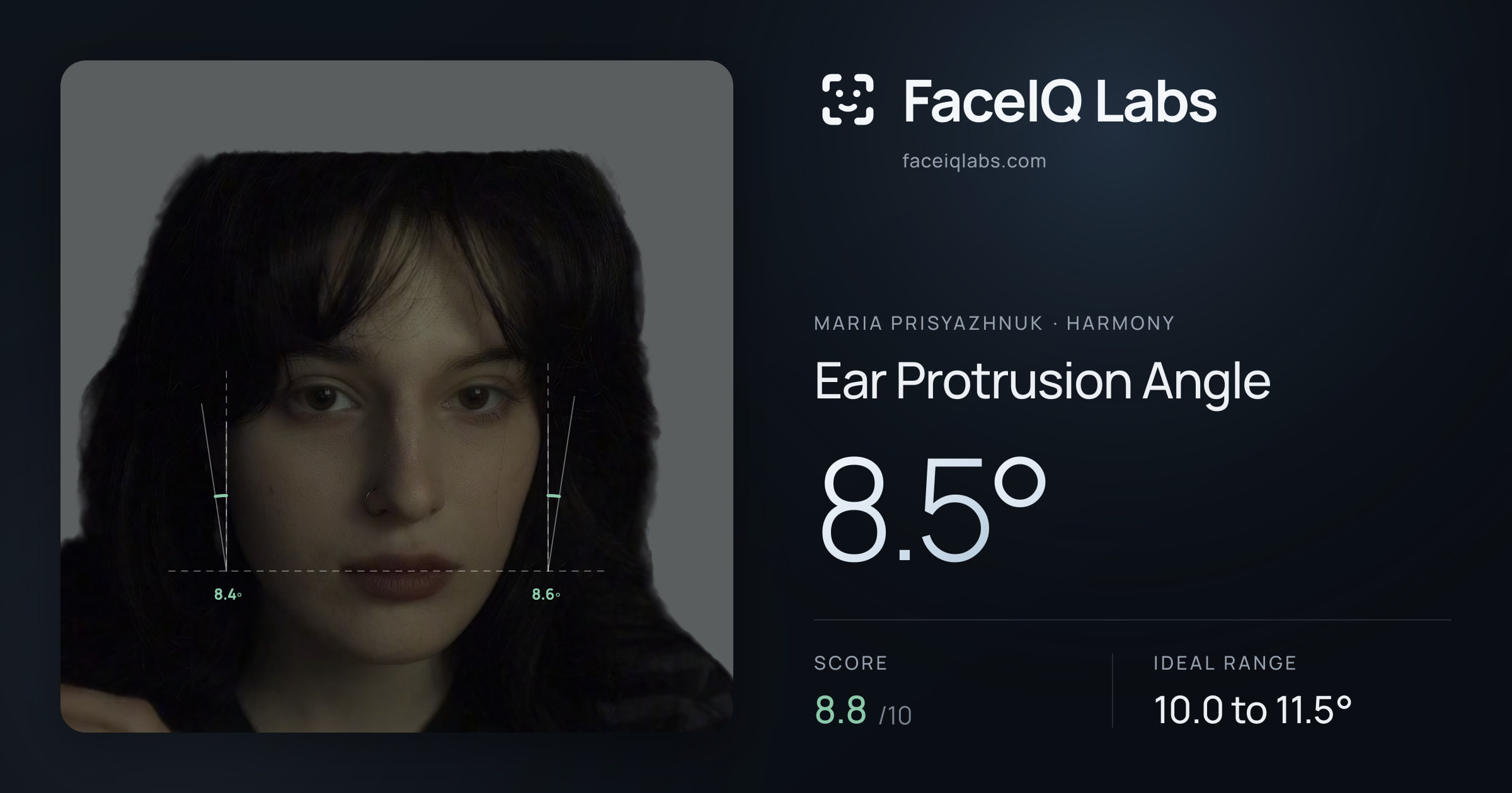 Maria Prisyazhnuk Ear Protrusion Angle: 8.5°, drawn on the photo
