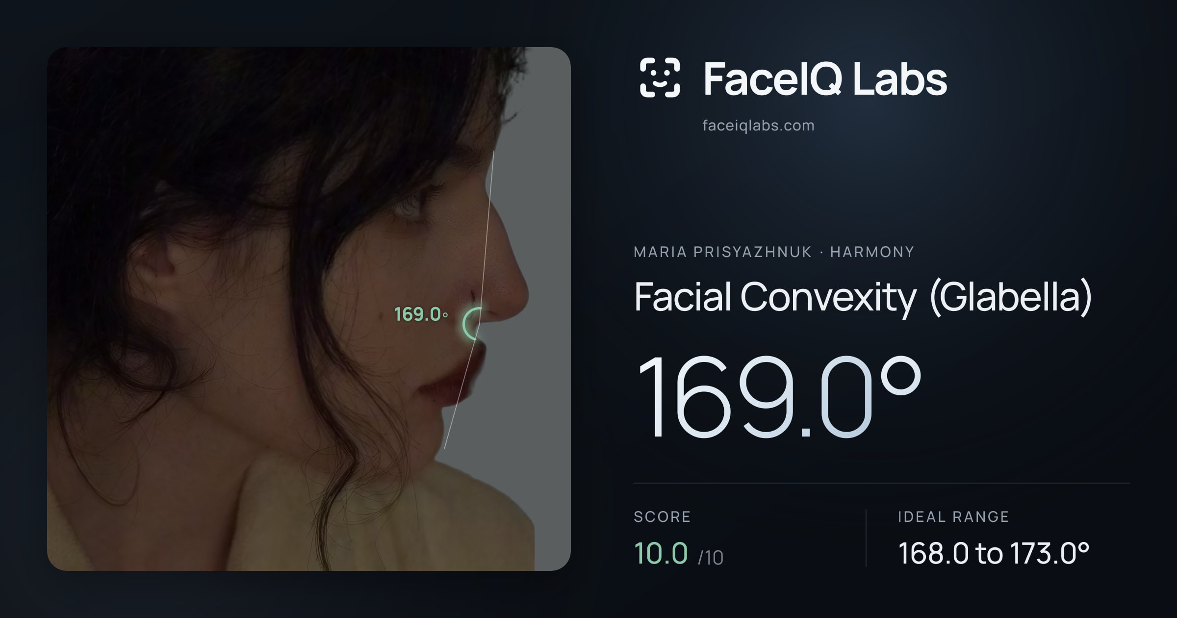 Maria Prisyazhnuk Facial Convexity (Glabella): 169.0°, drawn on the photo