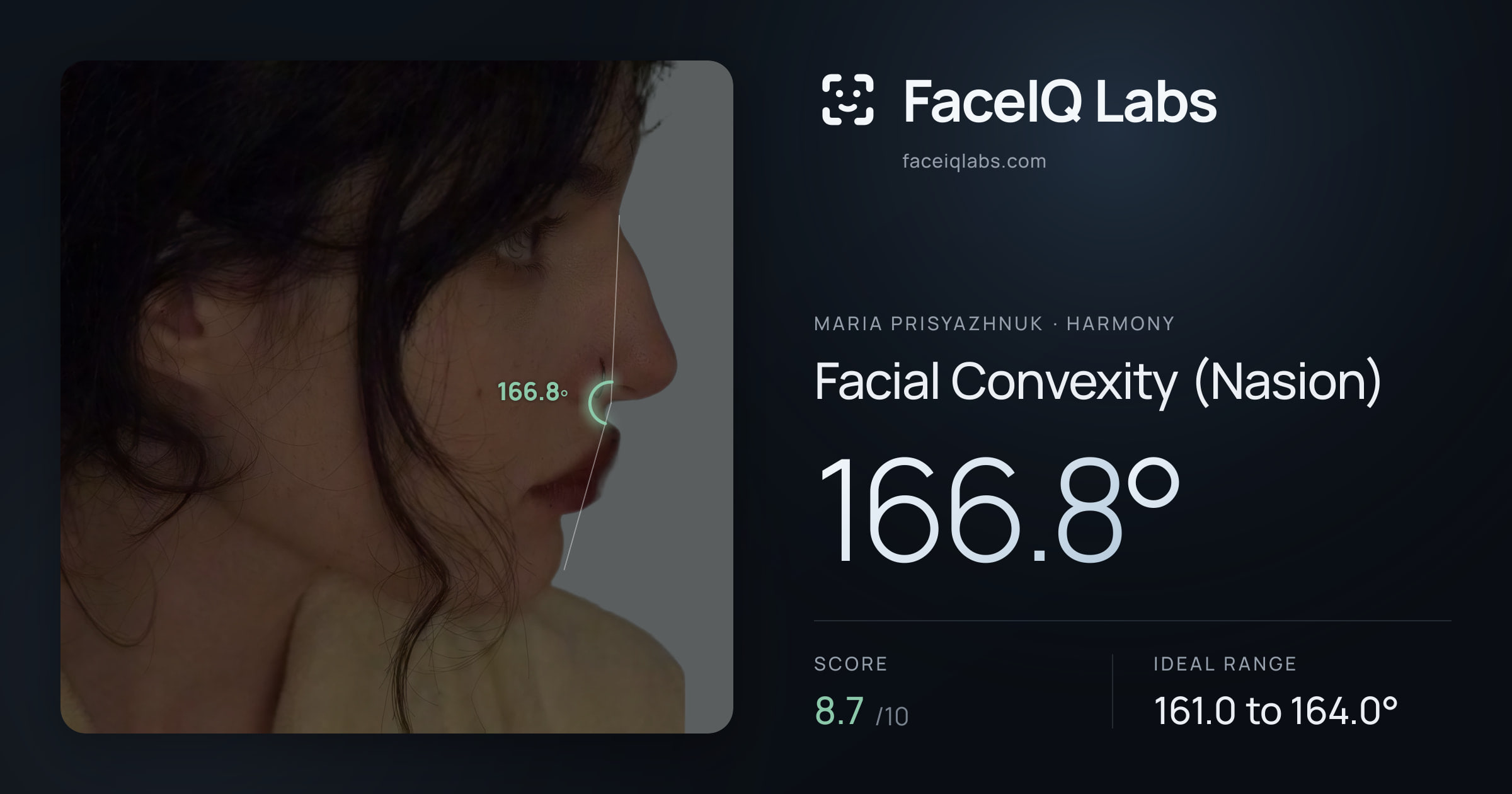 Maria Prisyazhnuk Facial Convexity (Nasion): 166.8°, drawn on the photo