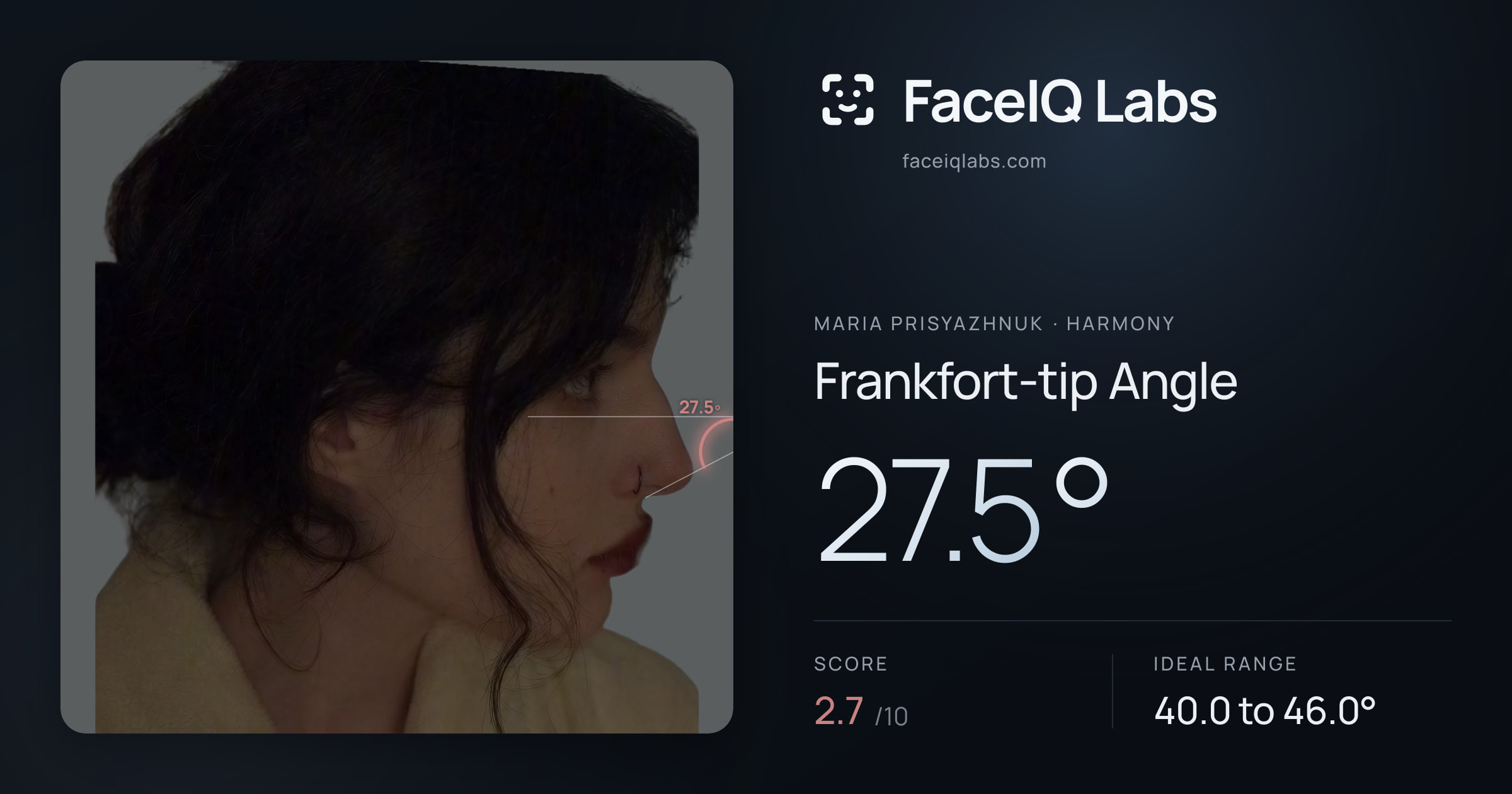 Maria Prisyazhnuk Frankfort-tip Angle: 27.5°, drawn on the photo