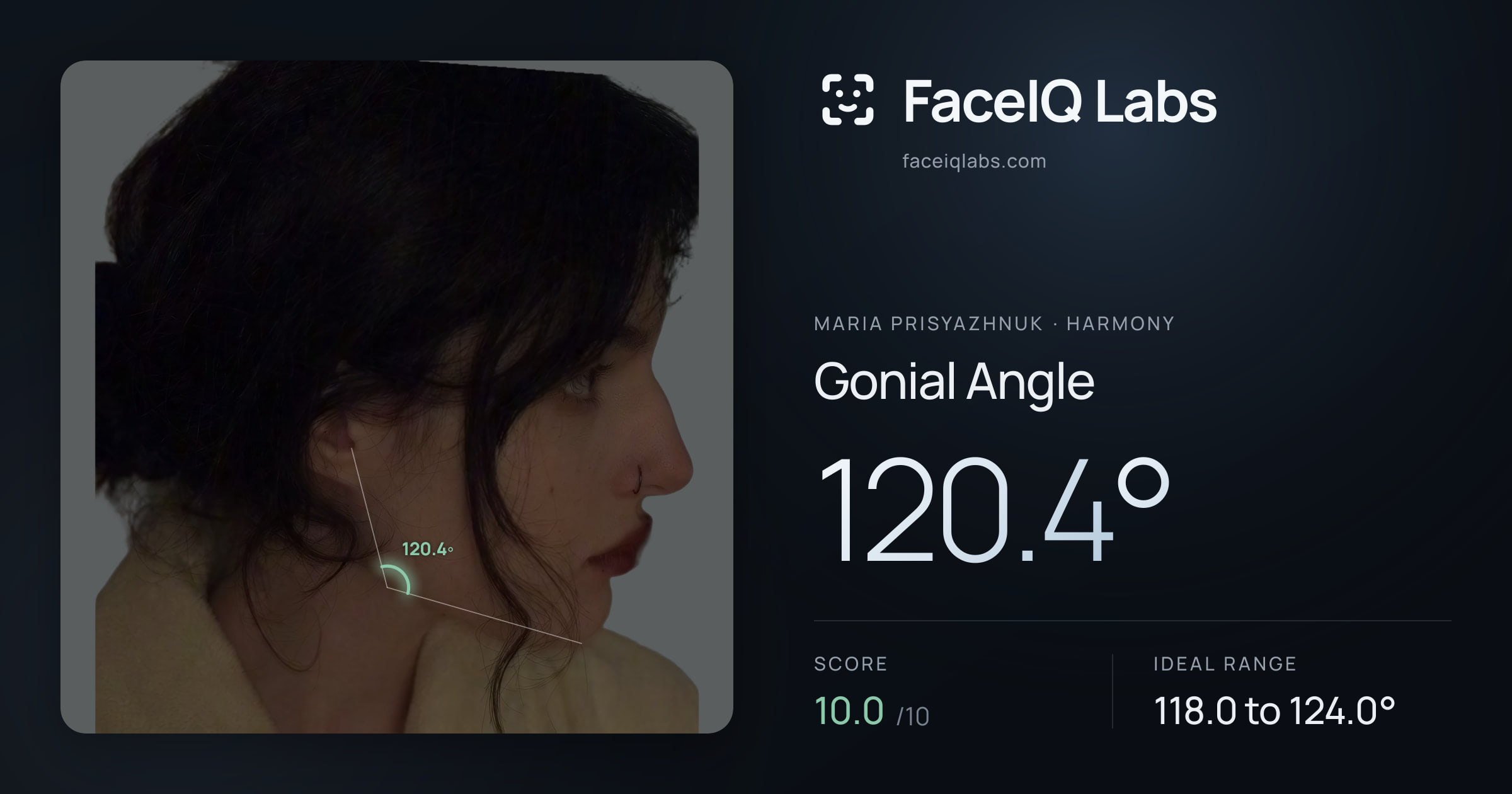 Maria Prisyazhnuk Gonial Angle: 120.4°, drawn on the photo
