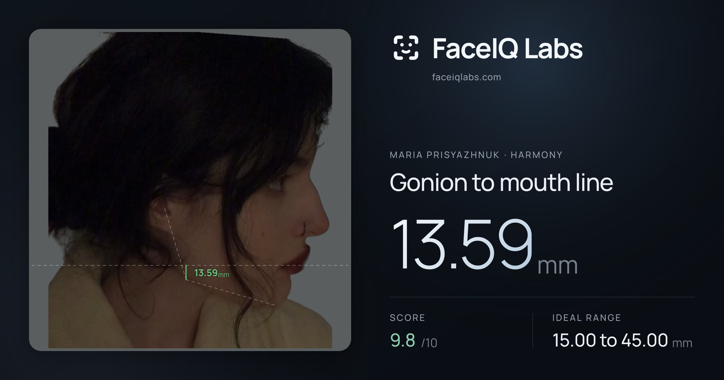 Maria Prisyazhnuk Gonion to mouth line: 13.59mm, drawn on the photo