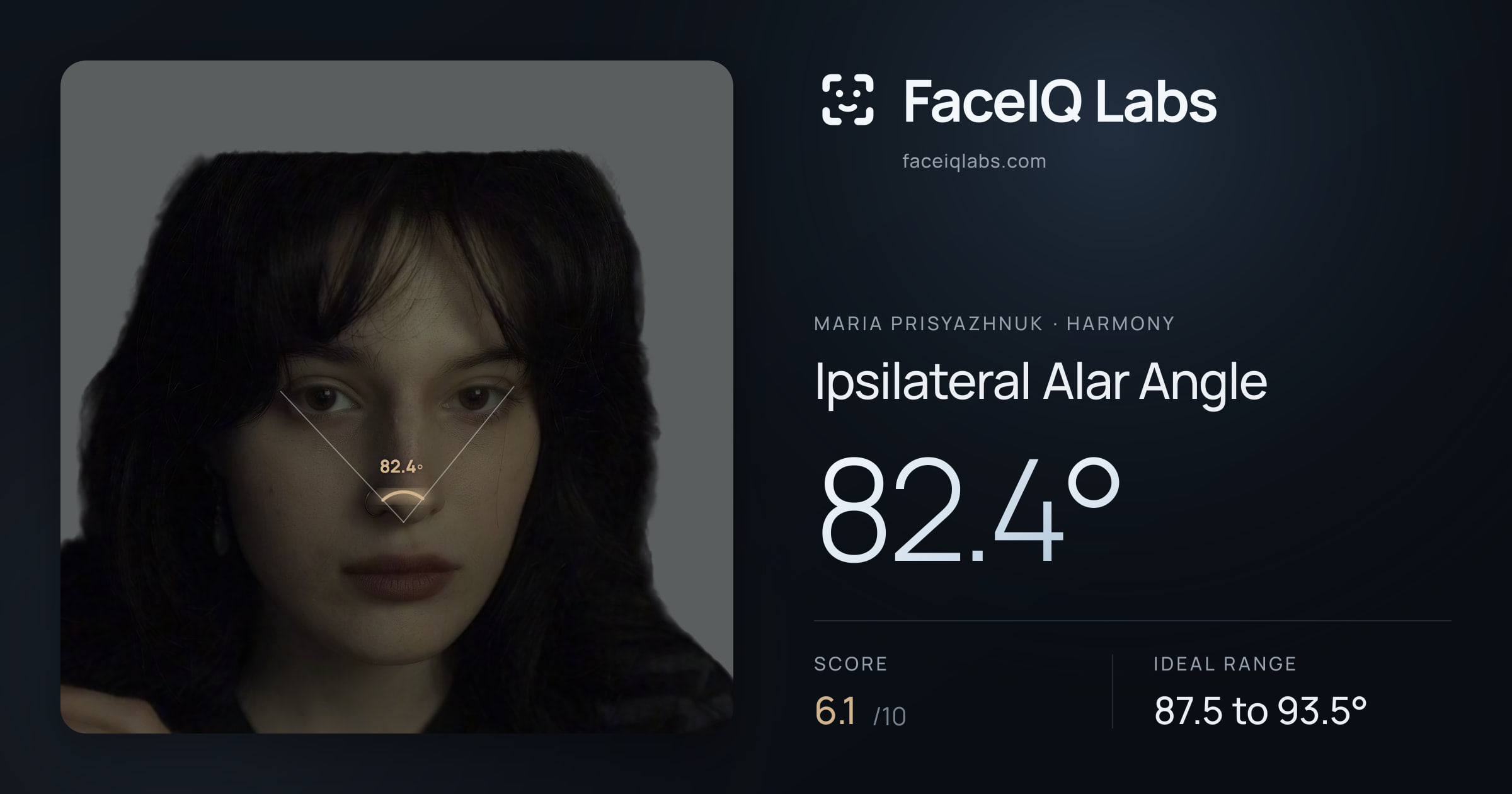Maria Prisyazhnuk Ipsilateral Alar Angle: 82.4°, drawn on the photo