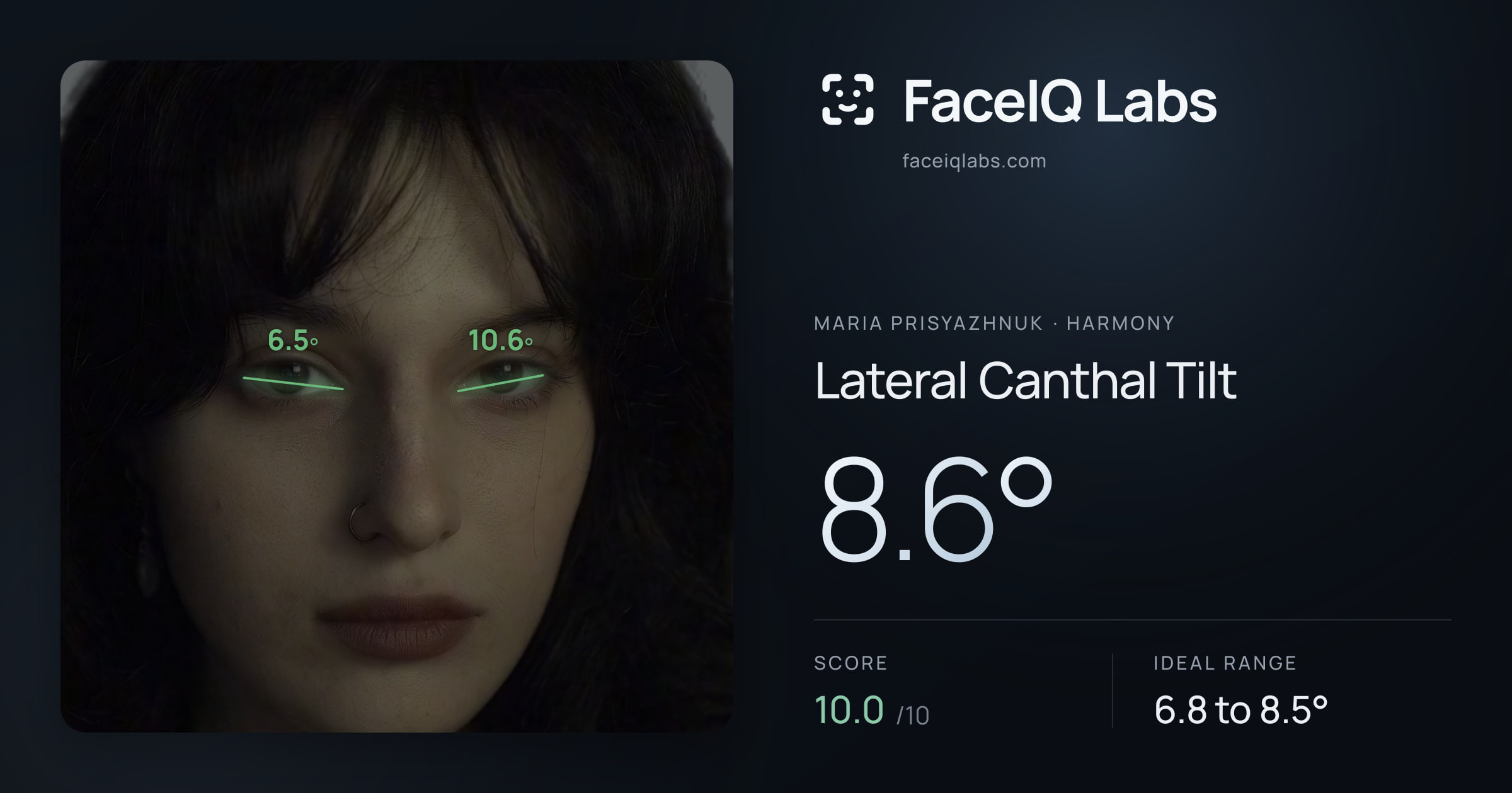 Maria Prisyazhnuk Lateral Canthal Tilt: 8.6°, drawn on the photo
