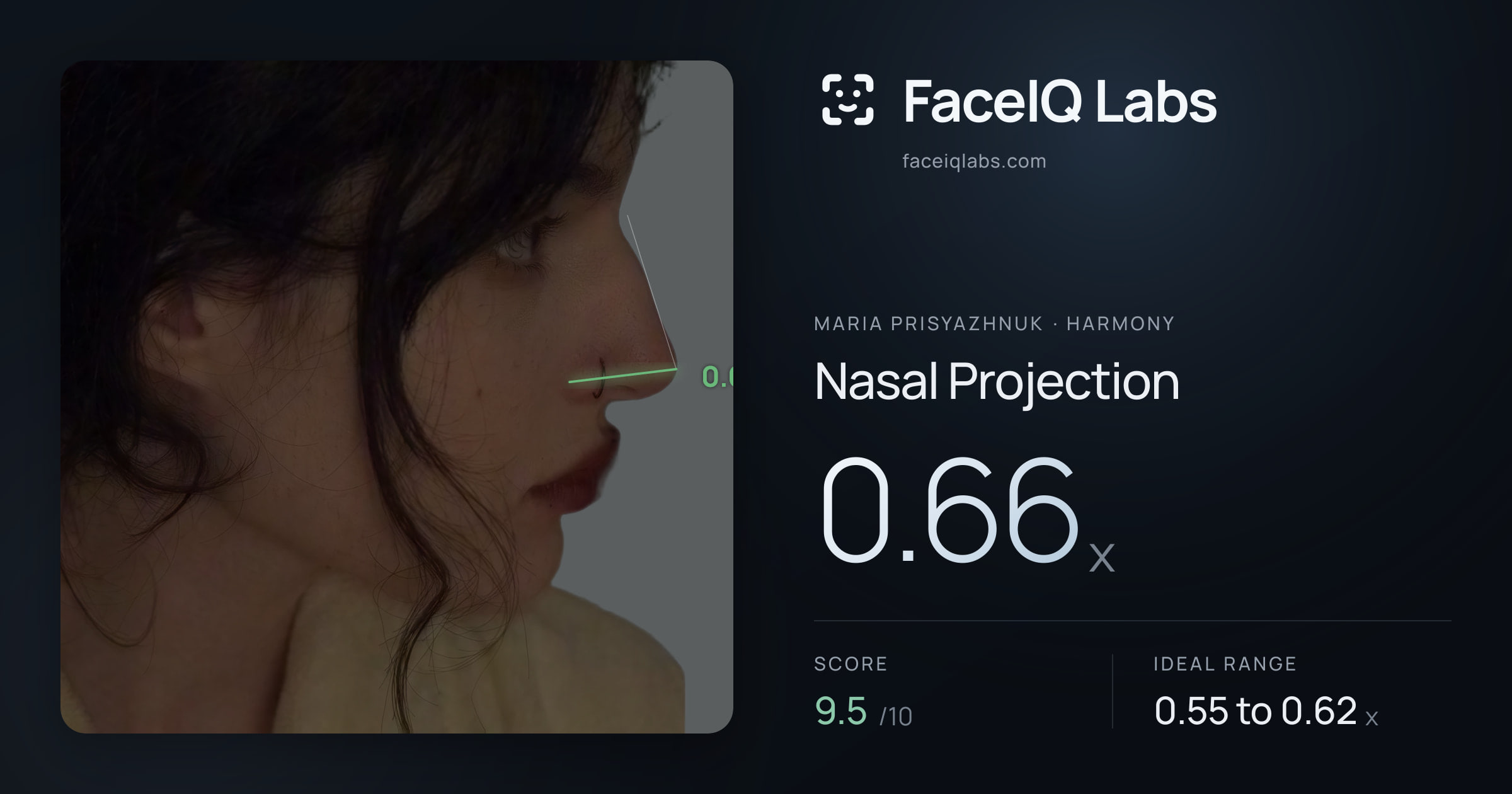 Maria Prisyazhnuk Nasal Projection: 0.66x, drawn on the photo