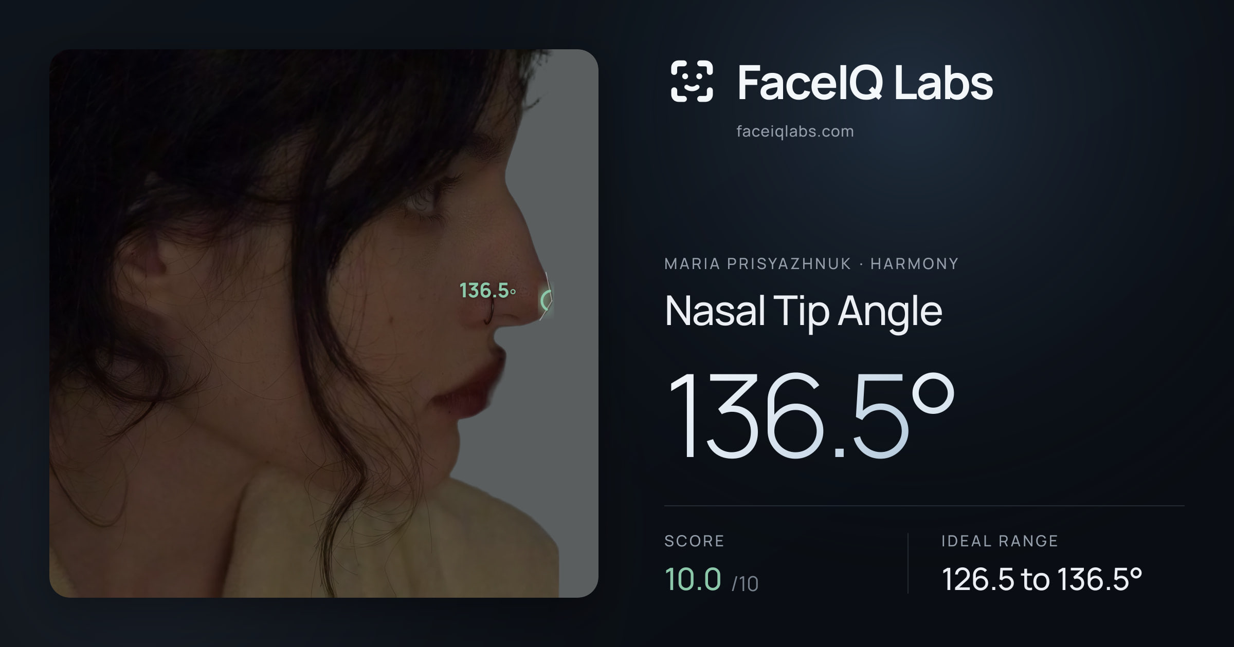 Maria Prisyazhnuk Nasal Tip Angle: 136.5°, drawn on the photo