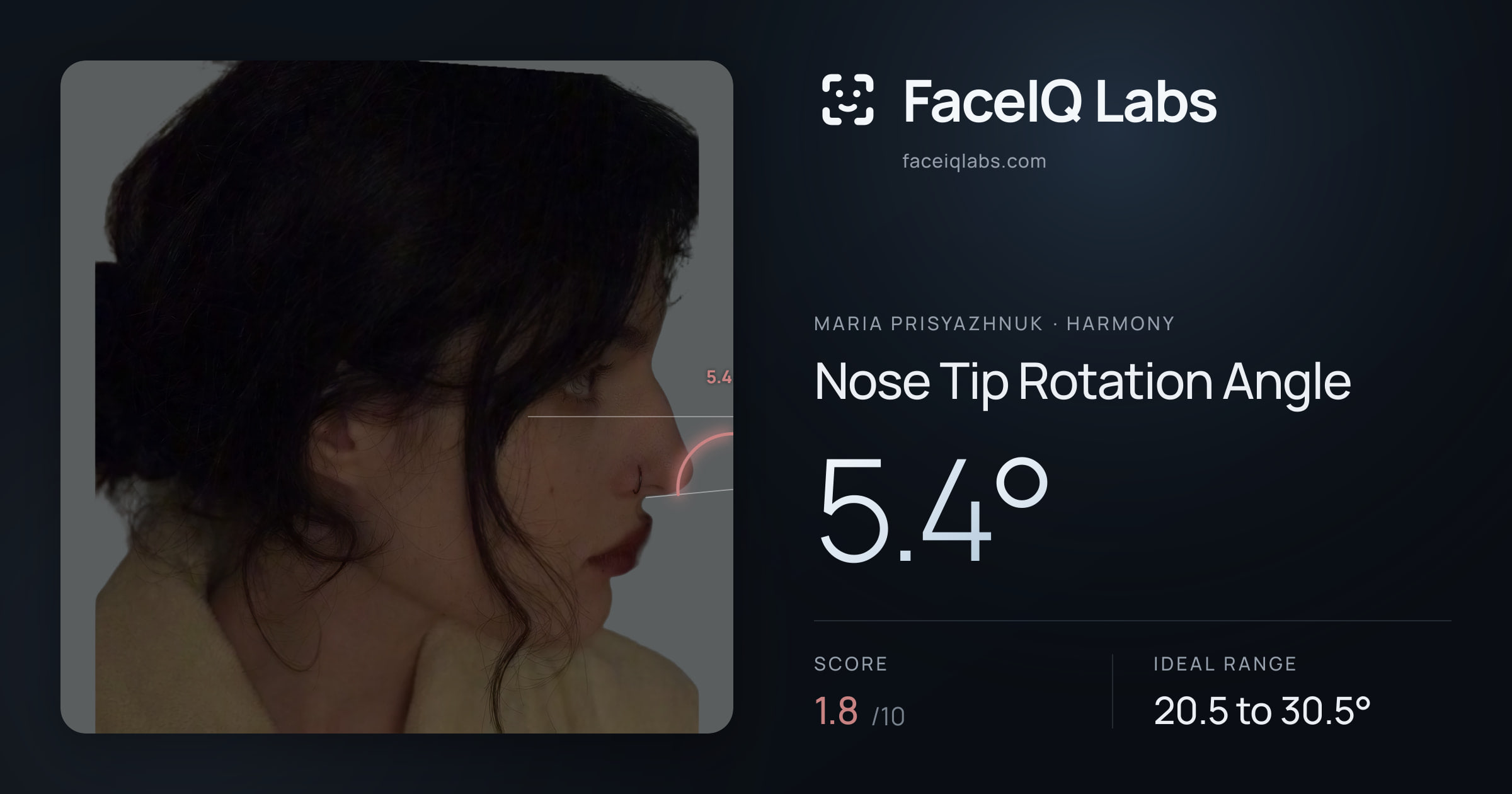 Maria Prisyazhnuk Nose Tip Rotation Angle: 5.4°, drawn on the photo