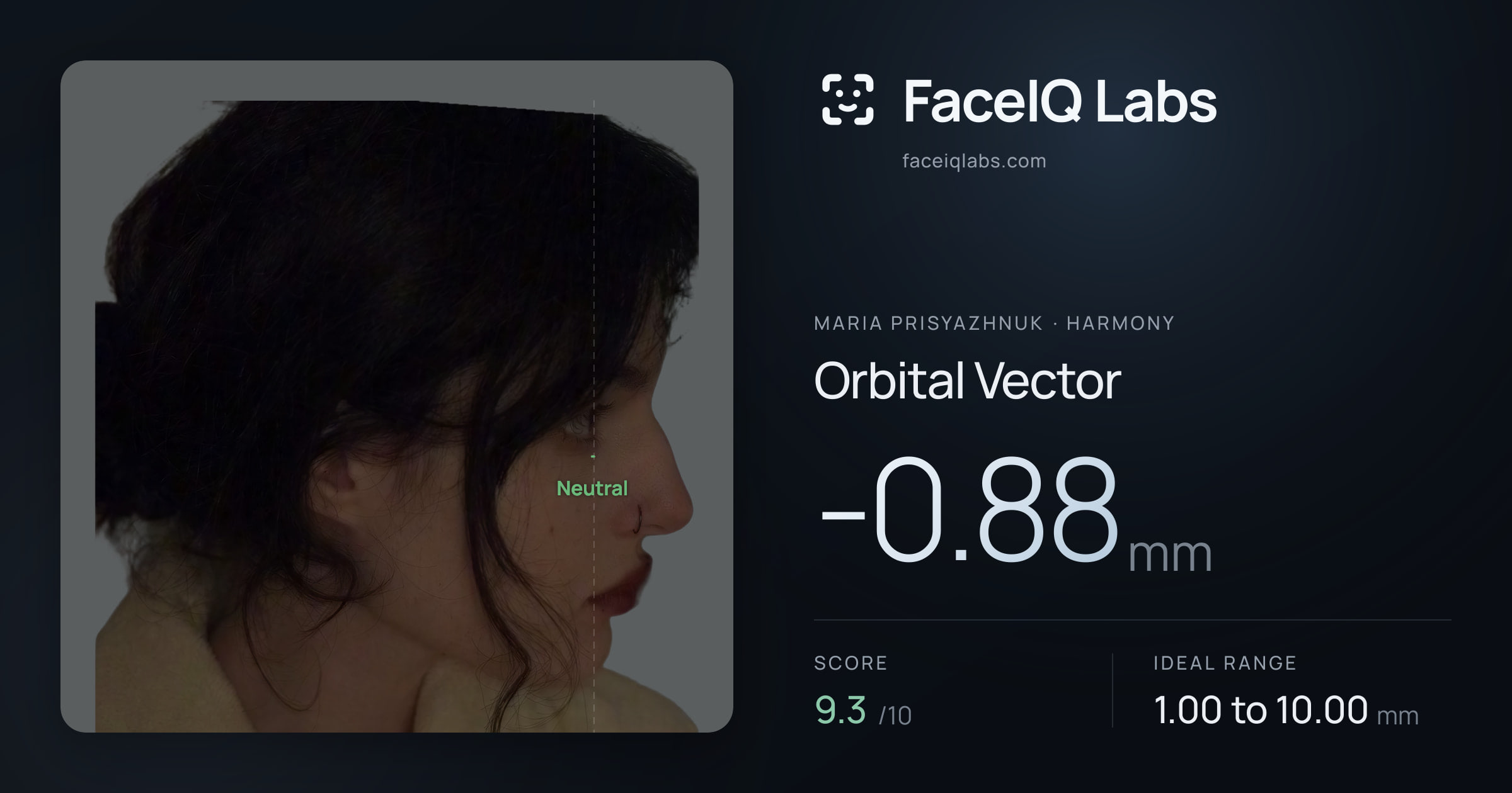 Maria Prisyazhnuk Orbital Vector: -0.88mm, drawn on the photo