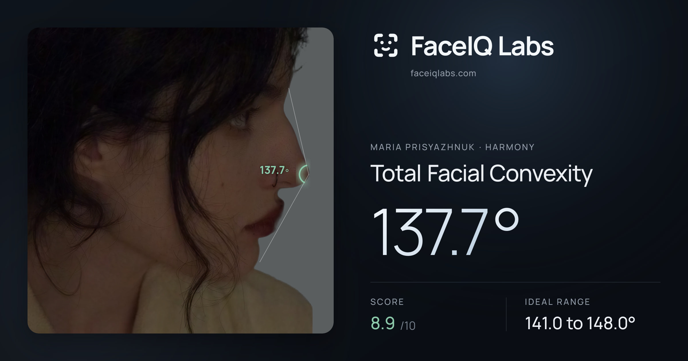 Maria Prisyazhnuk Total Facial Convexity: 137.7°, drawn on the photo