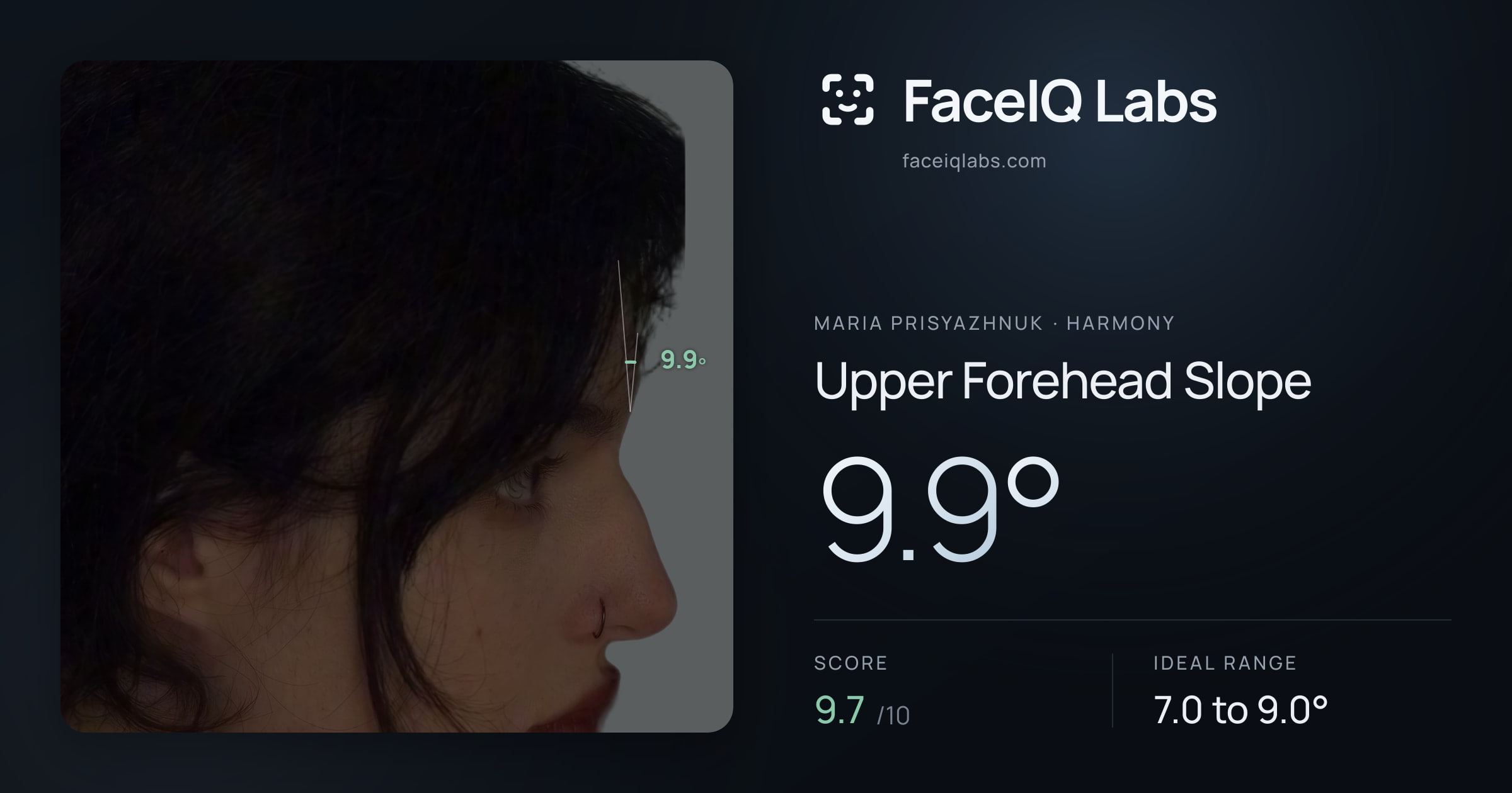 Maria Prisyazhnuk Upper Forehead Slope: 9.9°, drawn on the photo