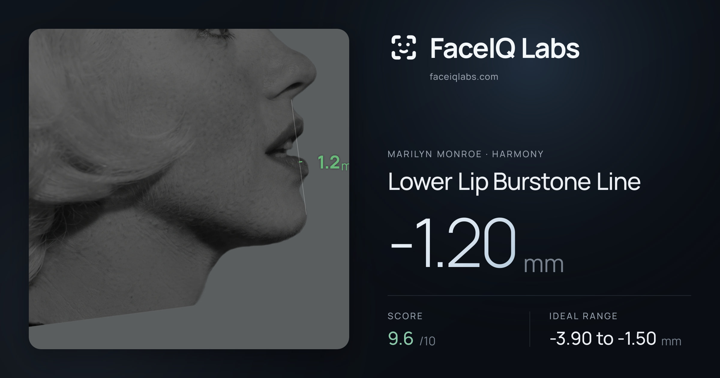 Marilyn Monroe Lower Lip Burstone Line: -1.20mm, drawn on the photo
