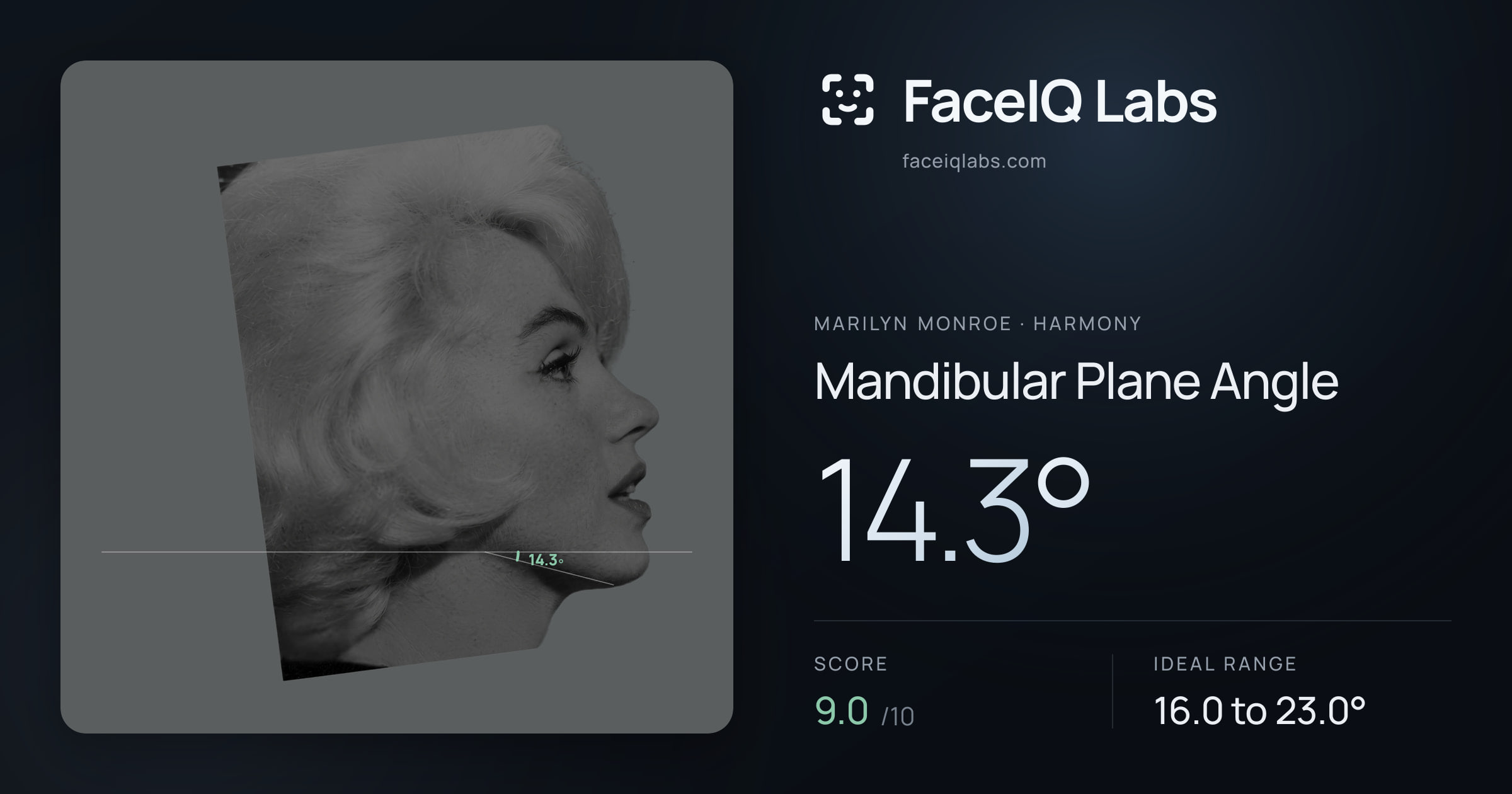 Marilyn Monroe Mandibular Plane Angle: 14.3°, drawn on the photo