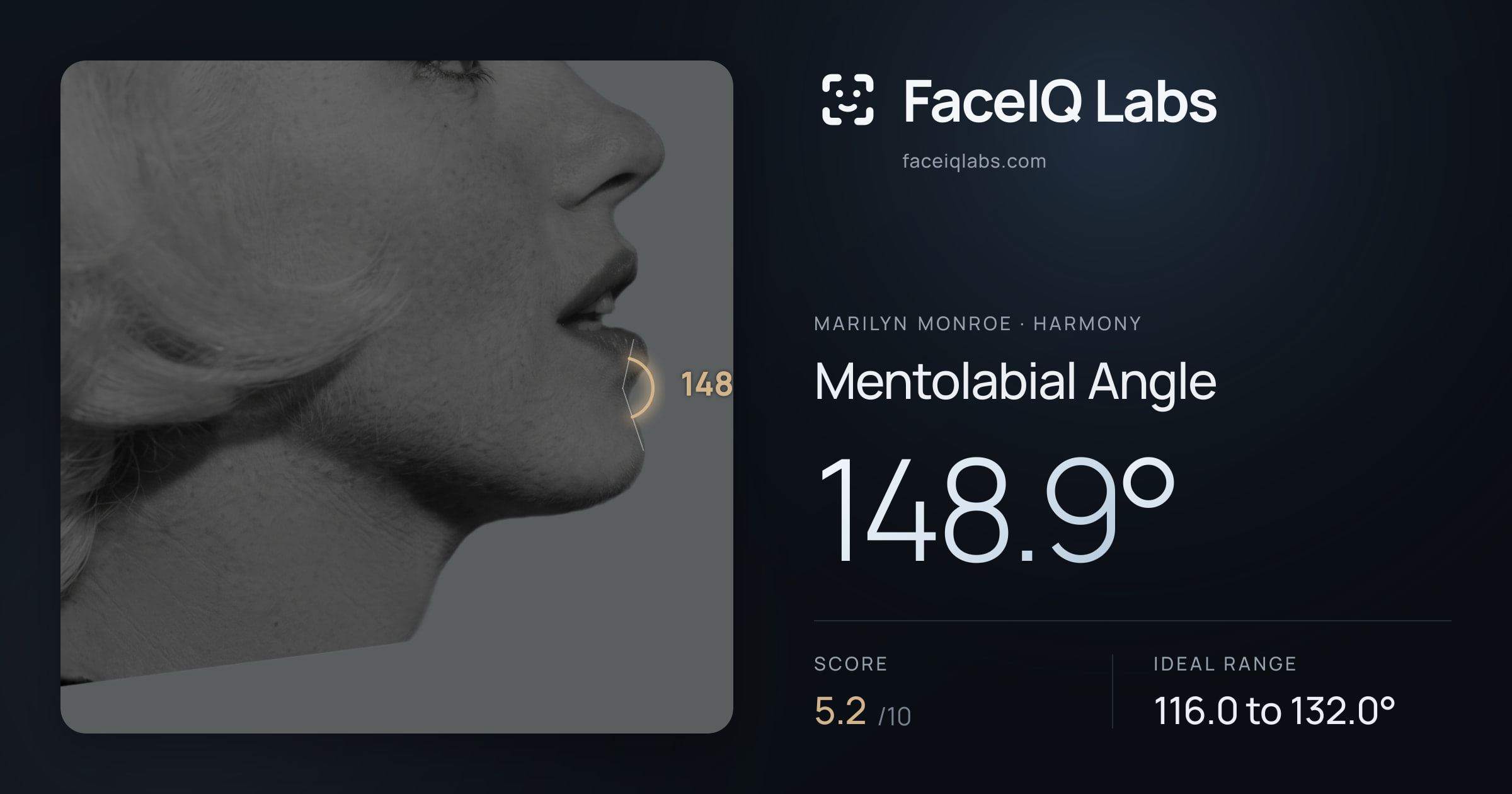 Marilyn Monroe Mentolabial Angle: 148.9°, drawn on the photo